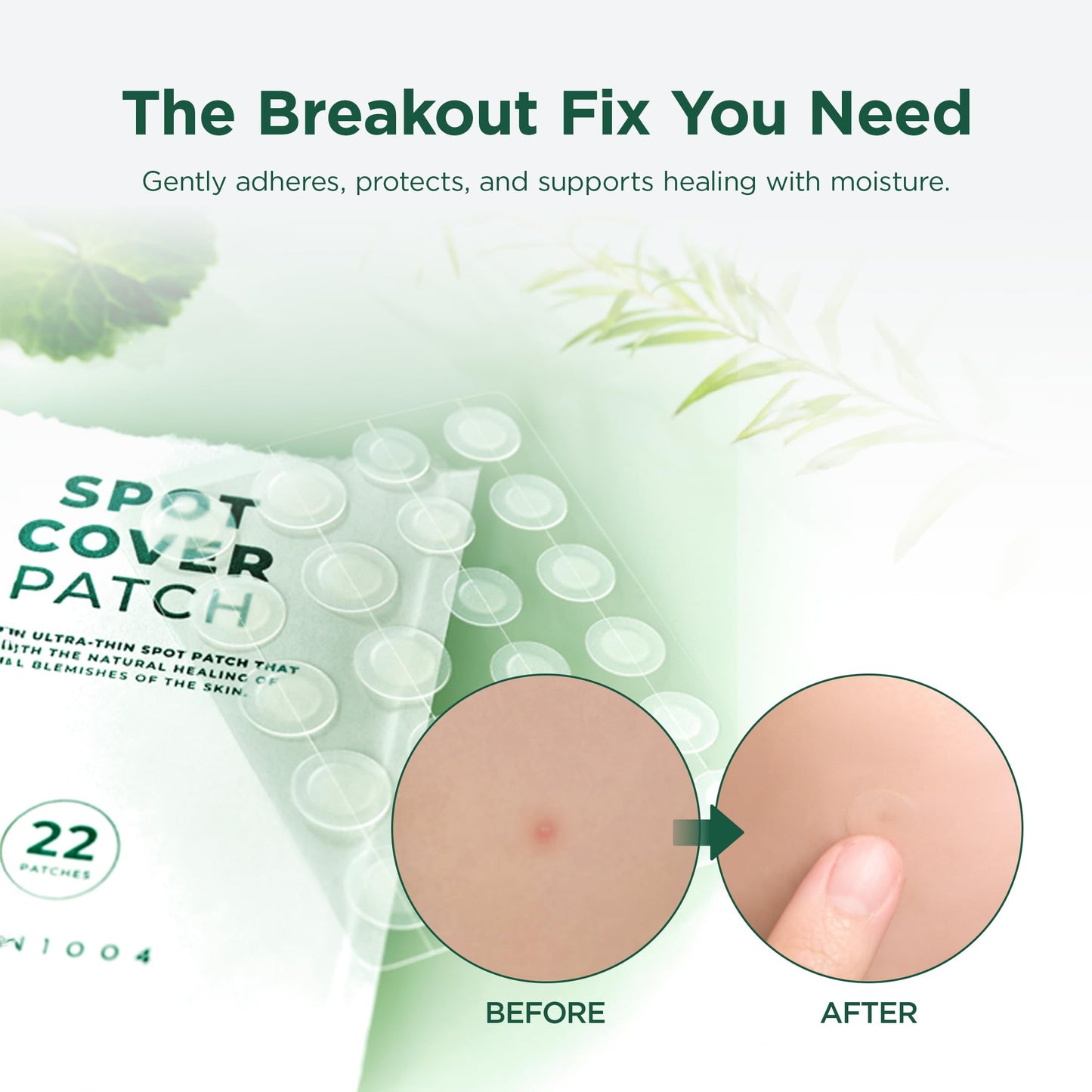 SKIN1004 Tea Trica Spot Cover Patch, Spot Patches for Blemish Prone Skin, Clear Hydrocolloid Pimple