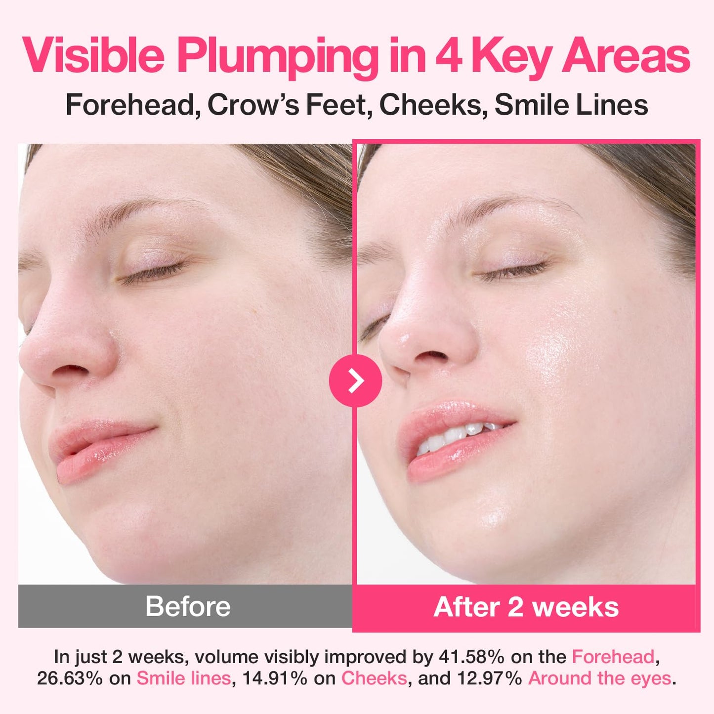 numbuzin No.2 Rose PDRN Collagen Plumping Serum, Hydrating & Firming Serum with Peptides, Plump