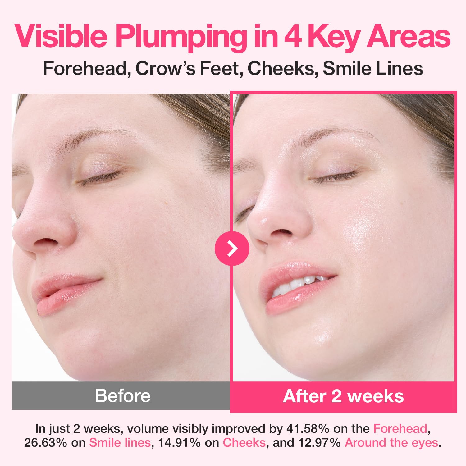 numbuzin No.2 Rose PDRN Collagen Plumping Serum, Hydrating & Firming Serum with Peptides, Plump