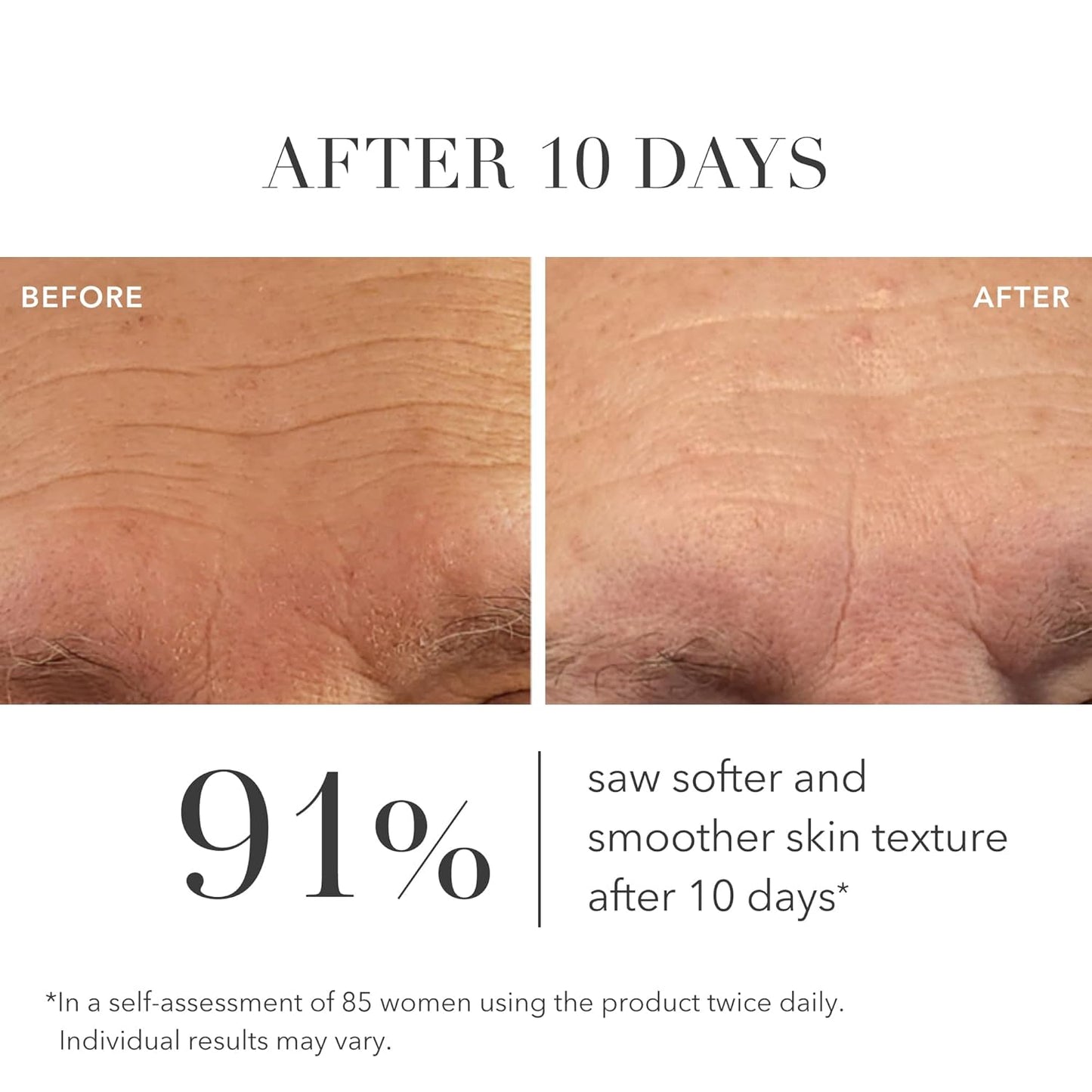 Algenist GENIUS Liquid Collagen Serum - Firming and Hydrating Face Serum with Collagen + Vitamin E - Helps Visibly Minimize Fine Lines + Wrinkles and Improve Elasticity (30ml)