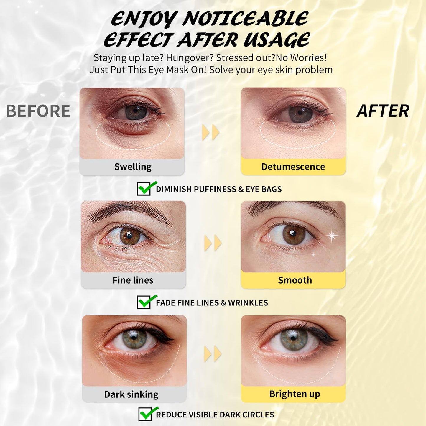 Under Eye Patches (25 Pairs), Caffeine Eye Masks for Dark Circles Puffy Eyes Undereye Bags, Collagen Eye Patches for Wrinkles and Puffiness, Skin Care Gift for Her