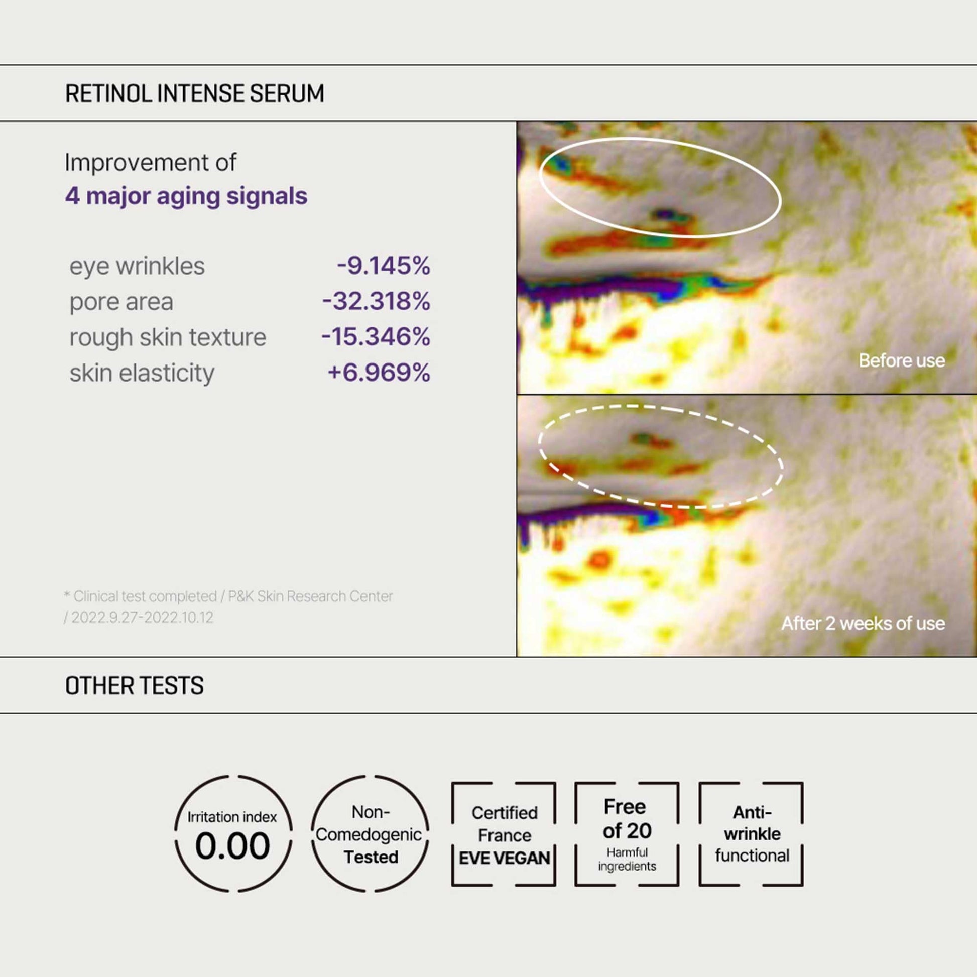 SOME BY MI Retinol Intense Trial Kit - Serum and Eye Cream, 0.33Oz - Mild Korean 0.1% Retinol Face