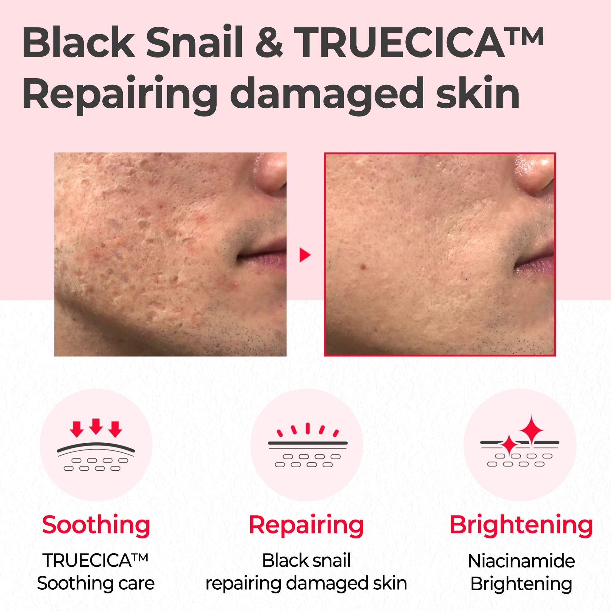 SOME BY MI Snail Truecica Miracle Repair Toner - 4.6Oz, 135ml - Made from Snail Mucin for Sensitive