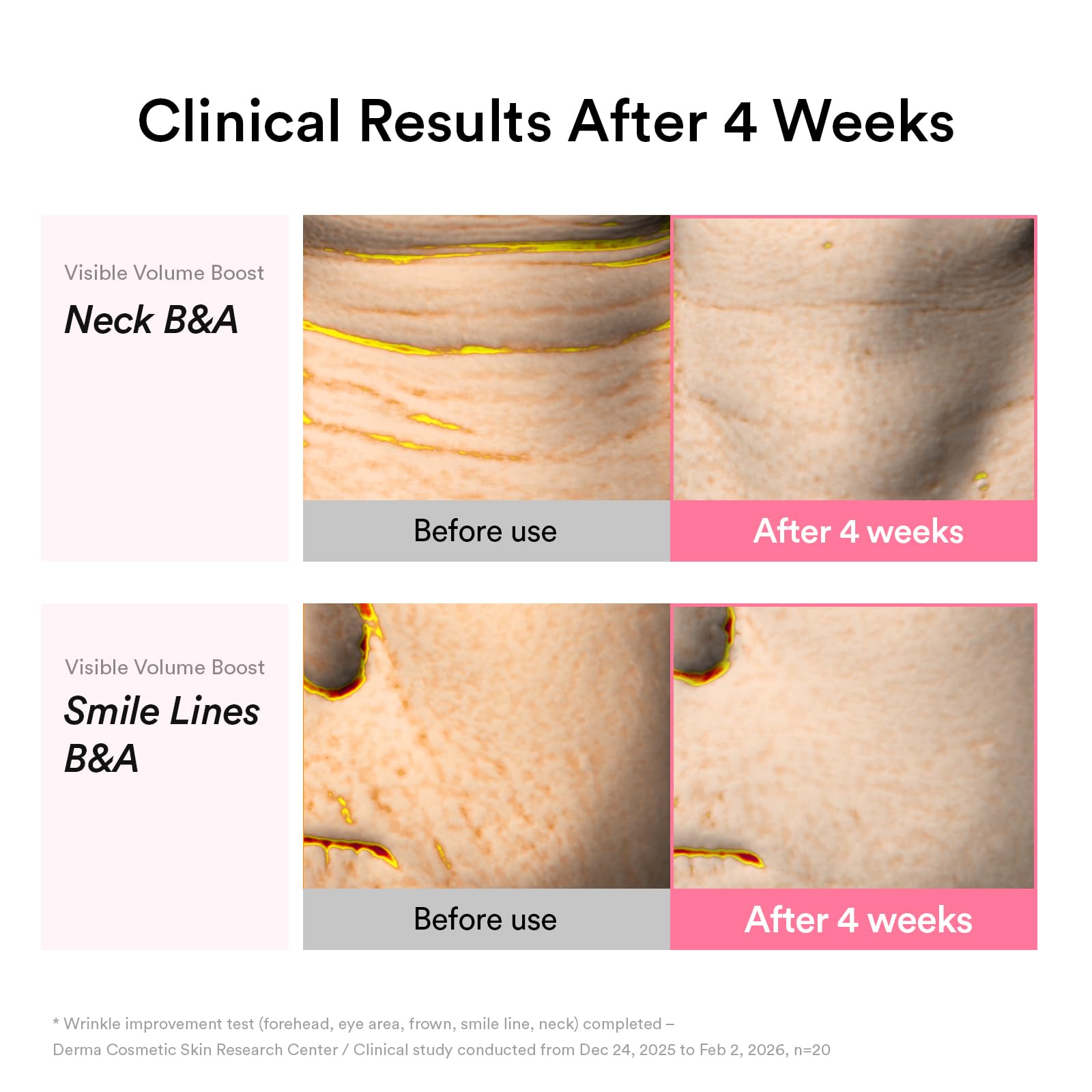 Abib PDRN Volume fill-it Booster Cream 2.5 tube | Facial Volume Plumping with PDRN 15,000ppm