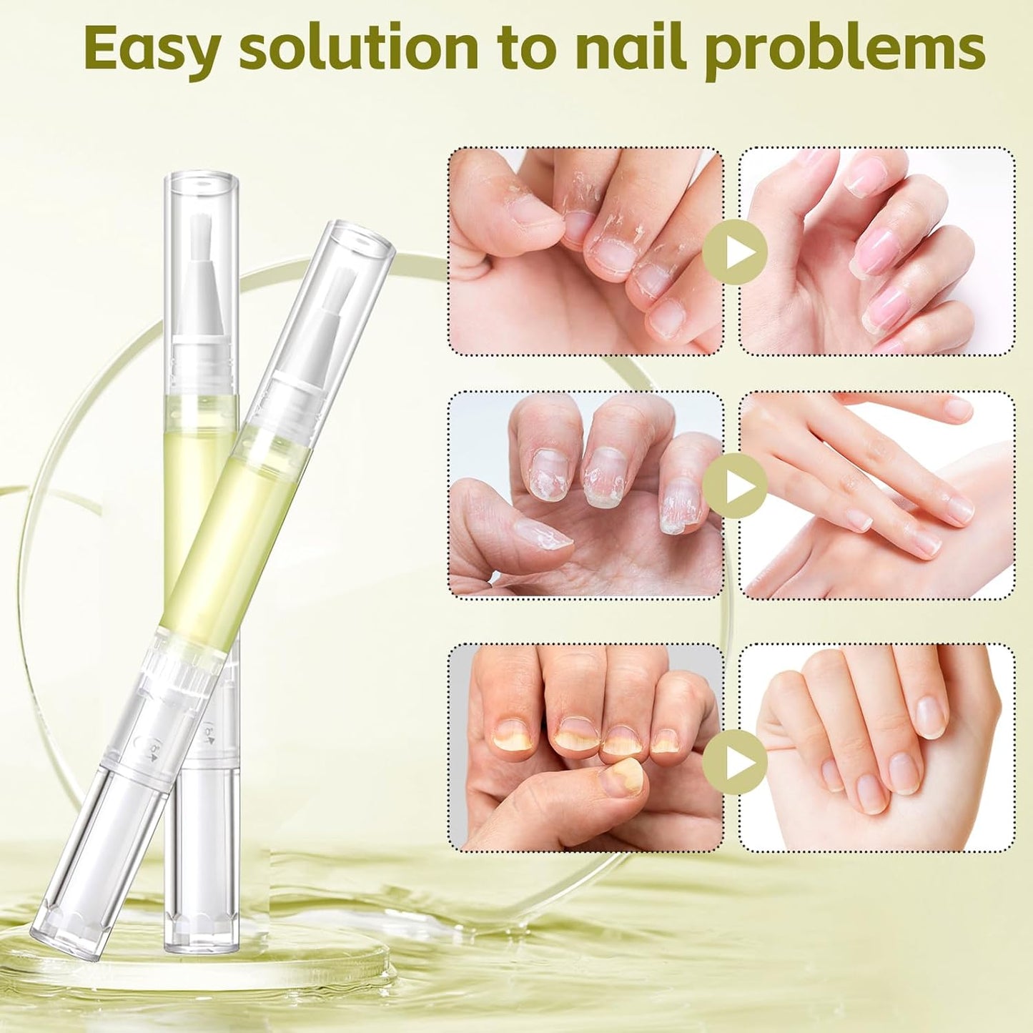 Nailz Nail 𝐆𝐫𝐨𝐰𝐭𝐡 Pen,Radiant Nail Growth GIL,Radiant Nail Growth Oil Pen,Cuticle Oil for Nails,Nail Strengthener, for Moisturize Strengthen Nail Care,Finger Edge Manicure Nourishing Pen(4PCS)