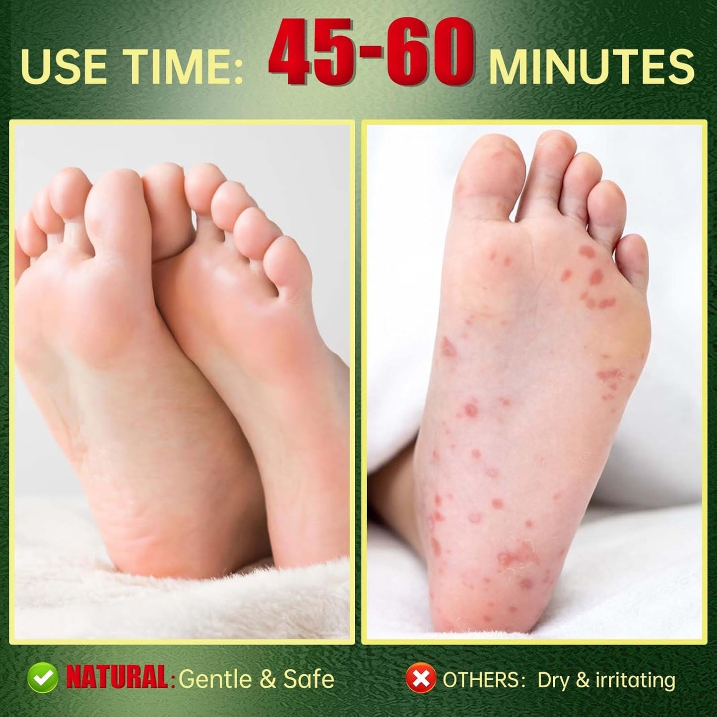 Foot Peeling Mask, Natural Exfoliating Foot Mask, Dead Skin Callus Remover Repair Heels, Hydrating Foot Care for Dry Cracked Feet（3 PacK）