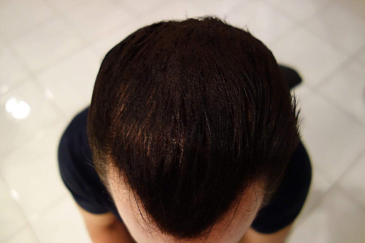 Hair Building Fibers 200 Grams 7 Oz. With Bottle By Finally Hair 50g*4 (Dark Chocolate Brown (deep dark brown))