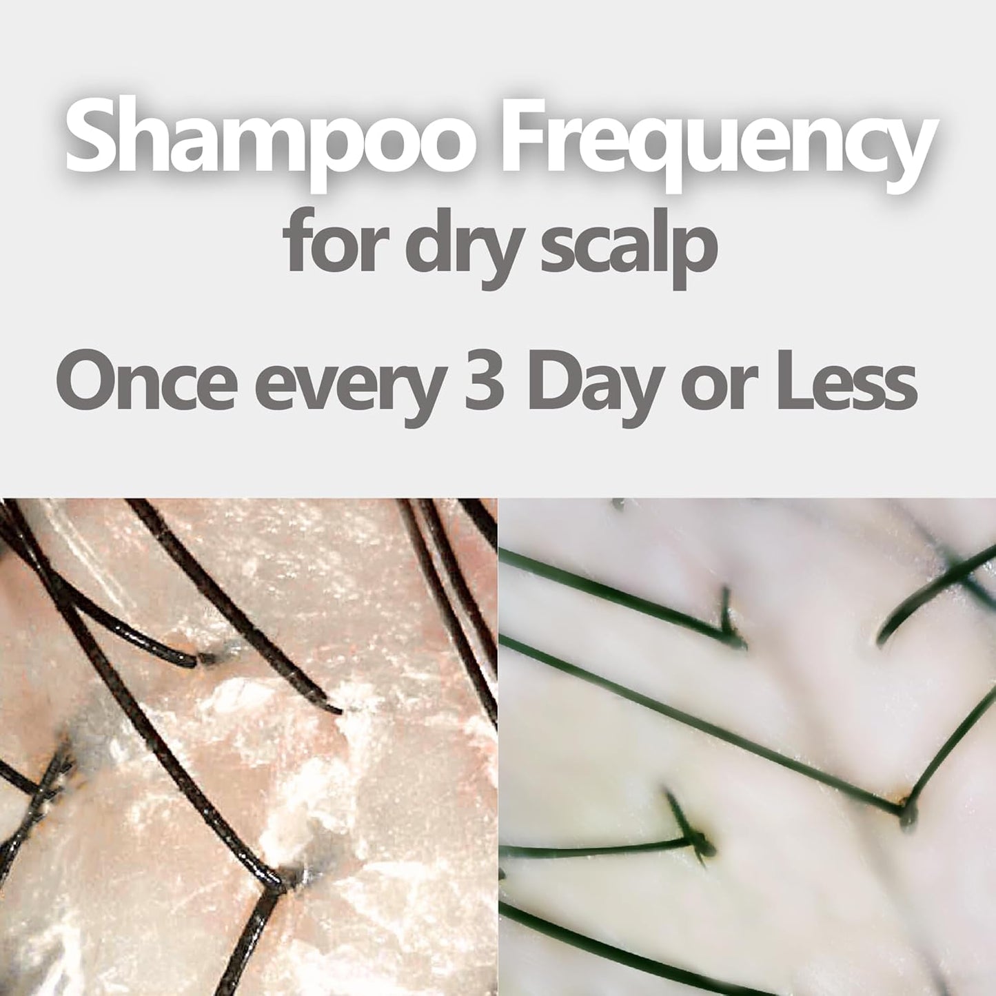 Aromase Dry Scalp Soothing Shampoo - Hydrates, Relieves Dryness and Itchiness - Amino Acid-Based Formula - No Parabens, SLS, or Silicone - 14 oz