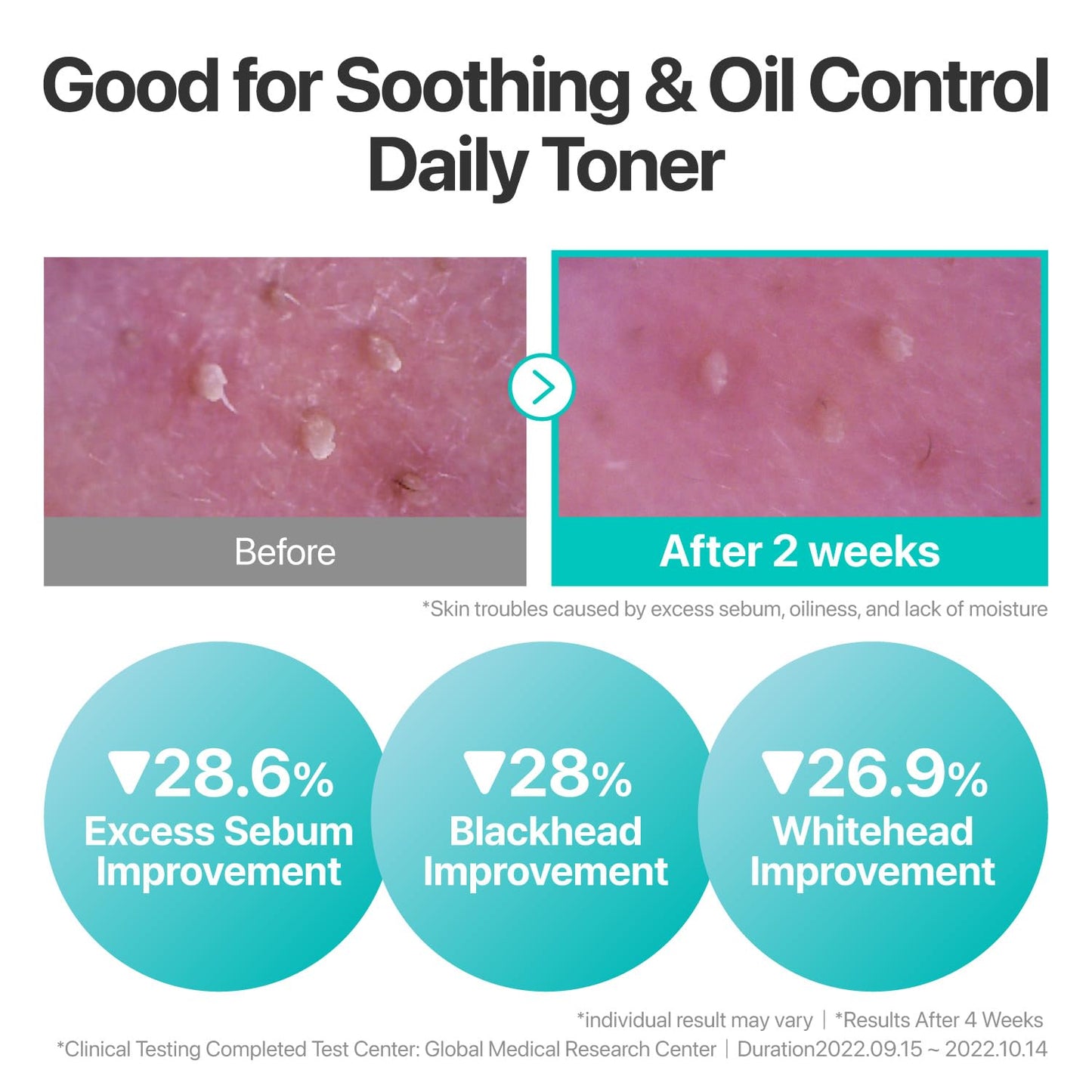 numbuzin No.1 Toner | Pure-Full Calming Herb Toner | Breakouts, Redness, Excess Oil Control |