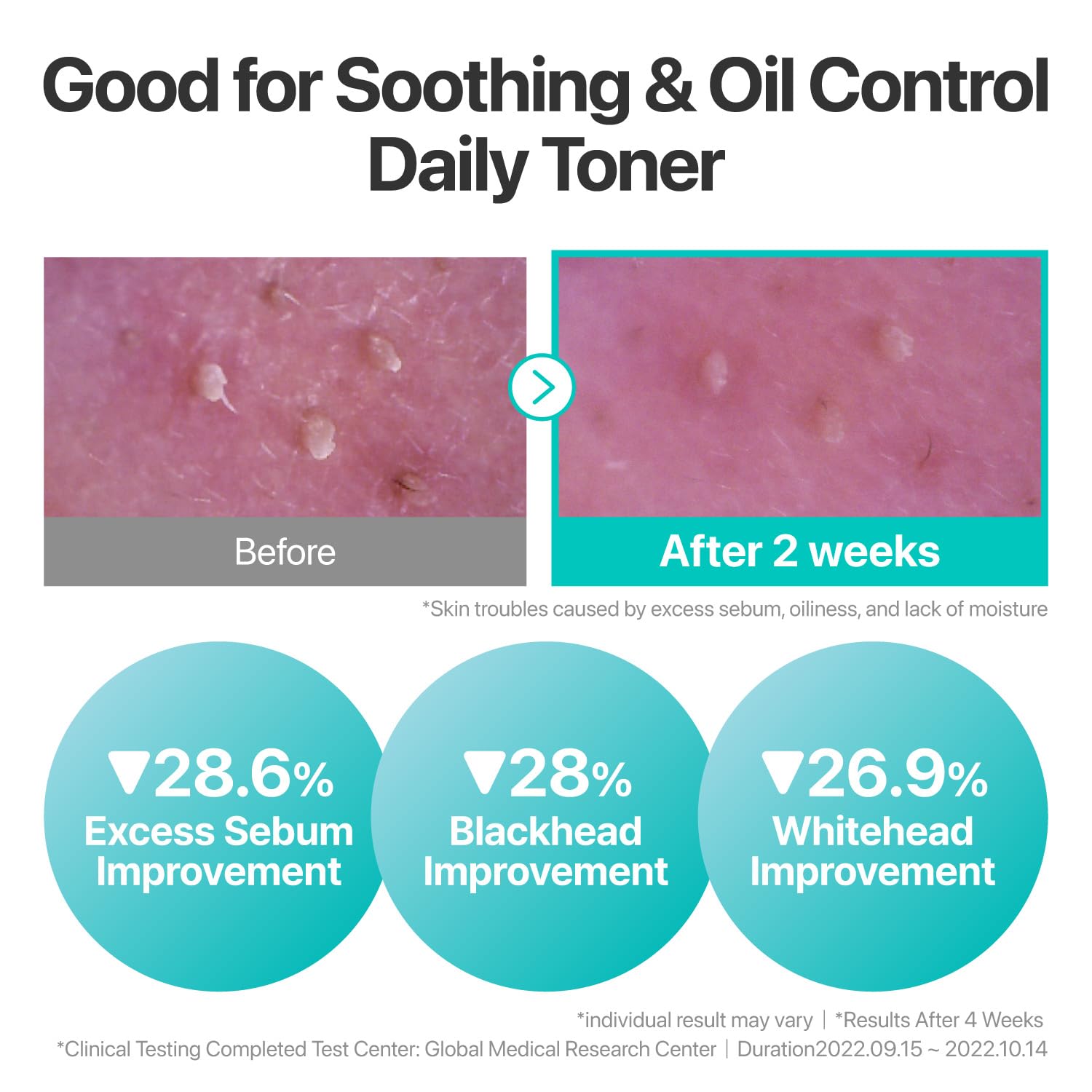 numbuzin No.1 Toner | Pure-Full Calming Herb Toner | Breakouts, Redness, Excess Oil Control |