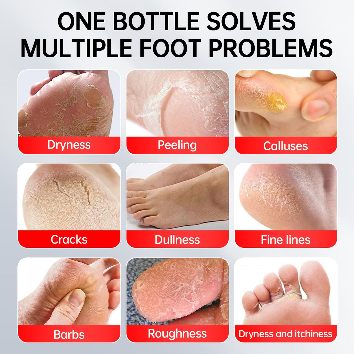 Urea Cream 40 Percent for Feet Maximum Strength, with Heel Protectors, Foot Moisturizer Cream for Dry Cracked Heels Rough Dead Dry Skin Foot Callus Remover - 5.29 Oz