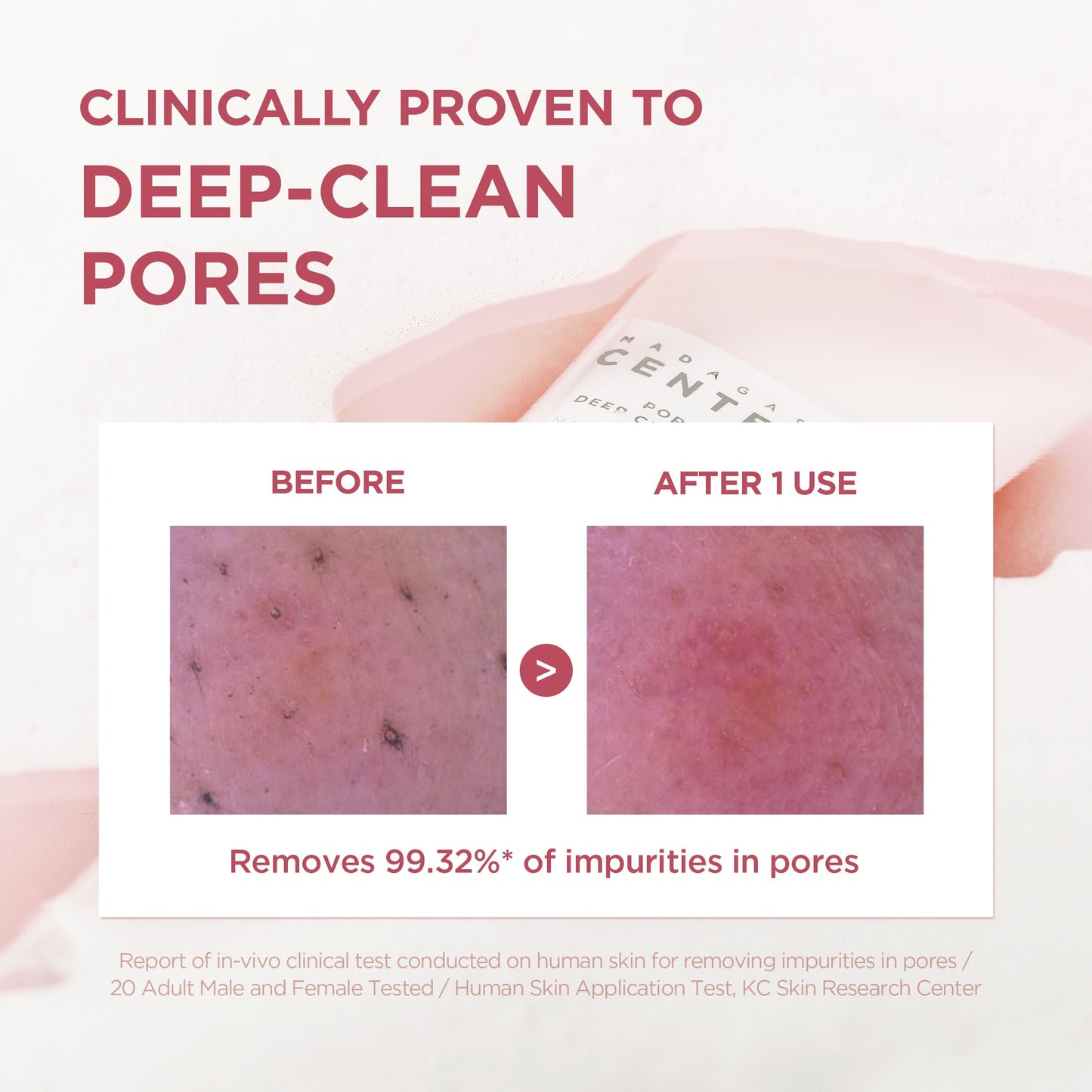 SKIN1004 Poremizing Deep Cleansing Foam, 4.23 fl.oz, 125ml, Makeup Remover, Korean Face Cleanser