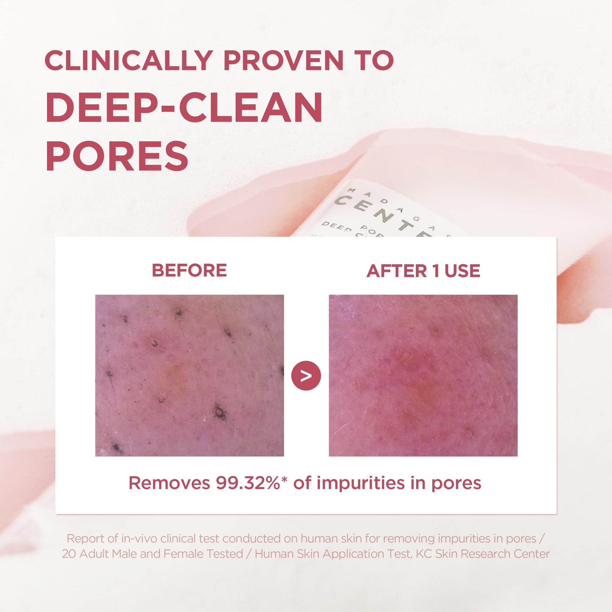 SKIN1004 Poremizing Deep Cleansing Foam, 4.23 fl.oz, 125ml, Makeup Remover, Korean Face Cleanser