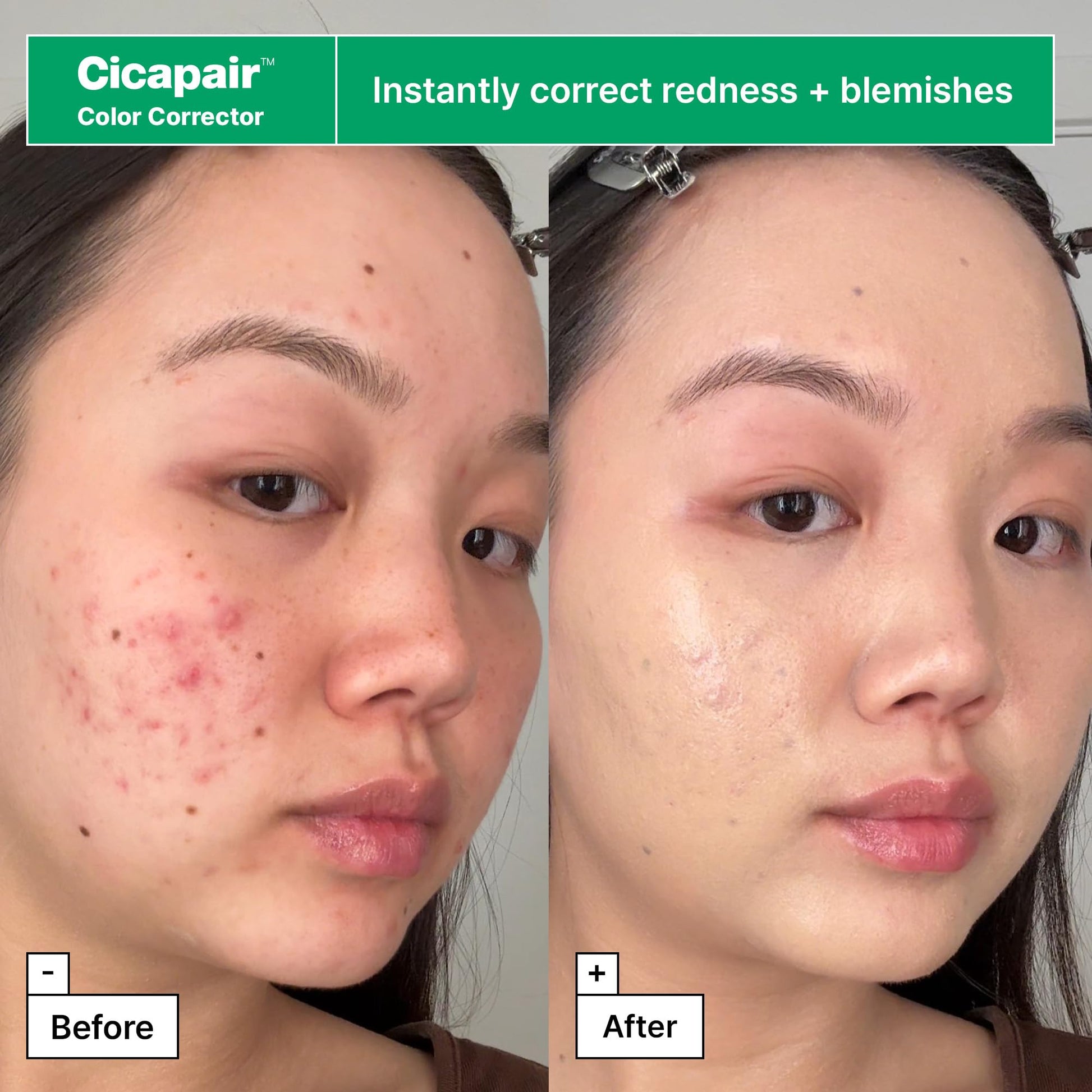 Dr.Jart+ Cicapair Redness Rescue Regimen Korean Skin Care Set with Centella Asiatica | 4 Piece