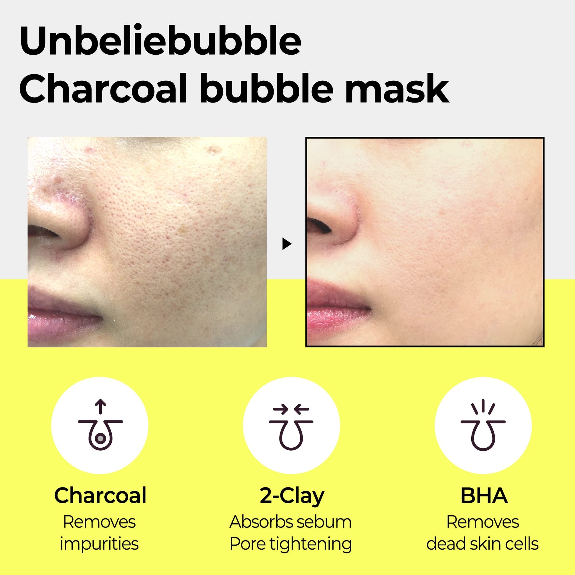 SOME BY MI Charcoal BHA Pore Clay Bubble Mask – 4.23oz, 120g – Korean Exfoliating Face Wash &