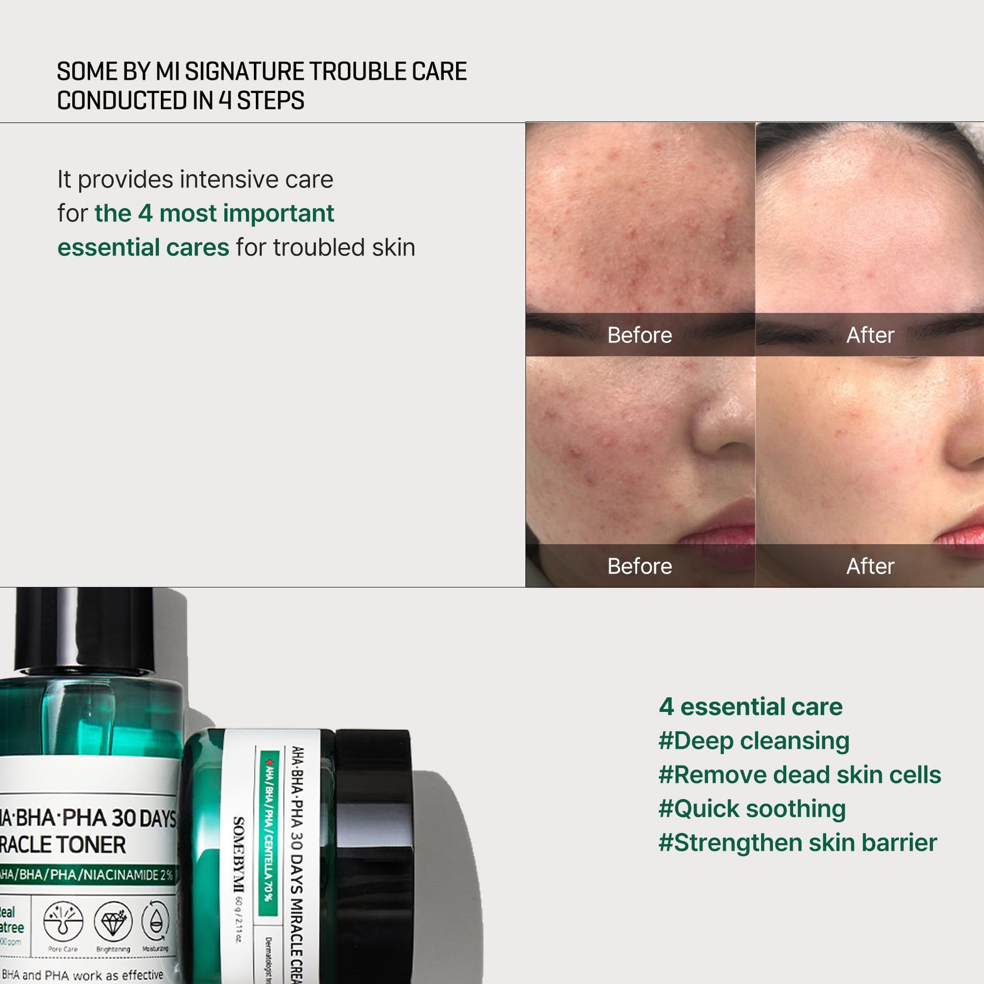 SOME BY MI AHA BHA PHA 30Days Starter Kit - Toner 1.01Oz, Serum 0.33Oz, Cream 0.7Oz, Cleansing Bar