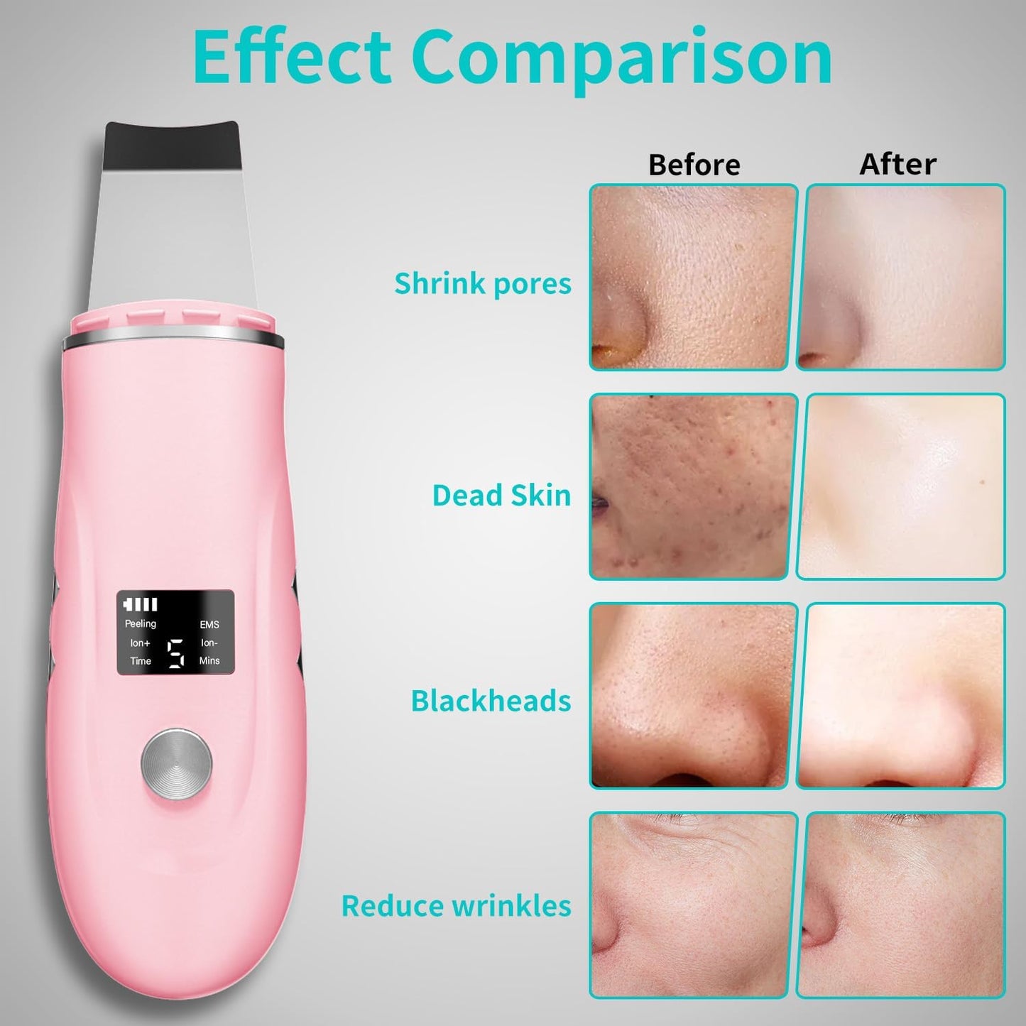 Face Scrubber Skin Spatula - Blackhead Remover Deep Cleansing Tool for Pore Extraction, 4-in-1 Fast Charging Dock Blackhead Remover Face Spatula for Facial Skincare Women Gift (Pink)