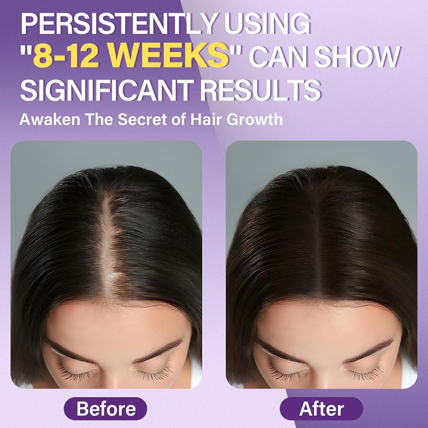 5% Minoxidil Foam for Women Hair Growth Foam Suitable for Hair Thinning Receding Hairline and Hair Loss to Hair Regrowth Get Thicker Fuller Hair 3 Bottles 2.11 Ounces Each