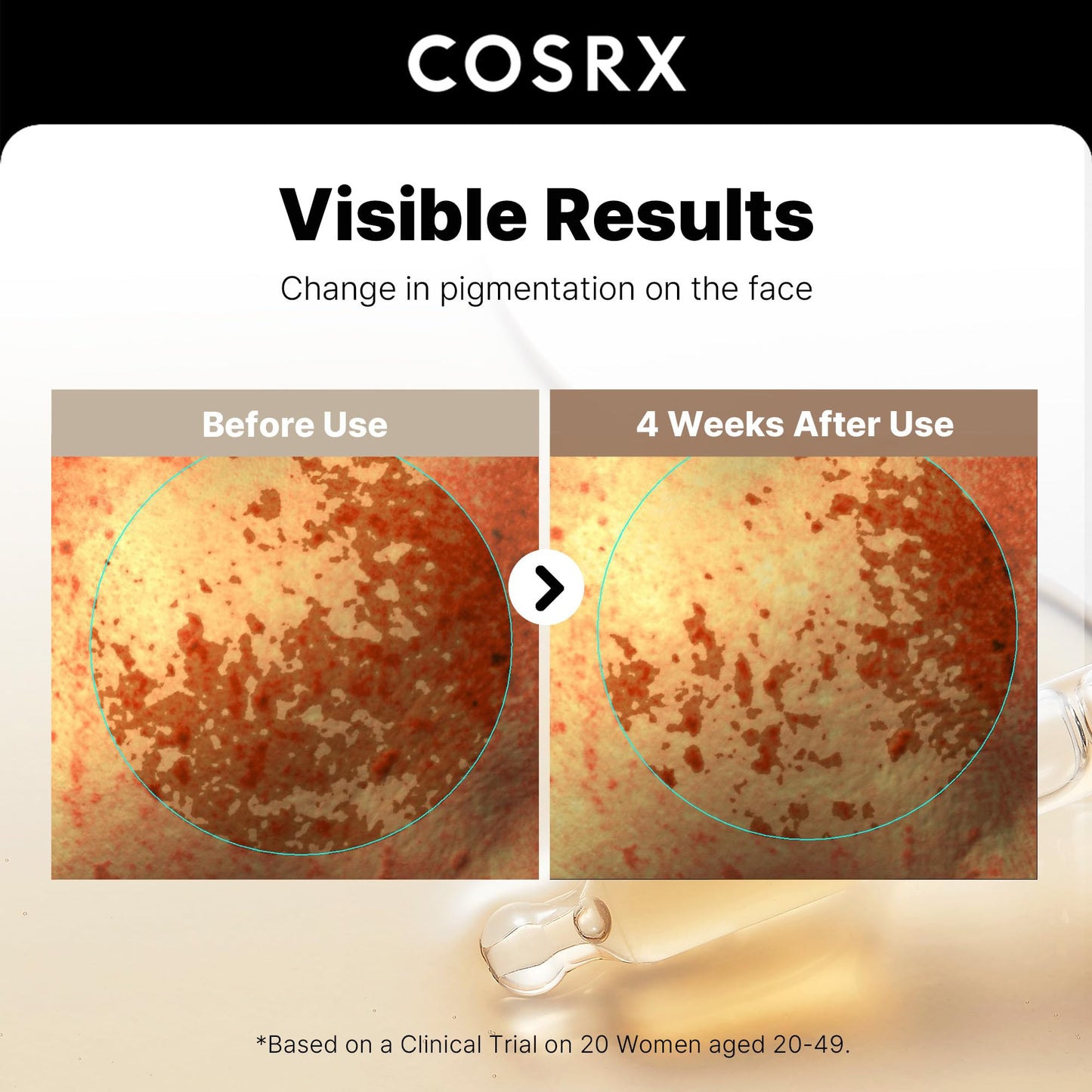 COSRX 2% Alpha Arbutin Discoloration Care Serum, Dark Spot Care, 1.7 fl oz