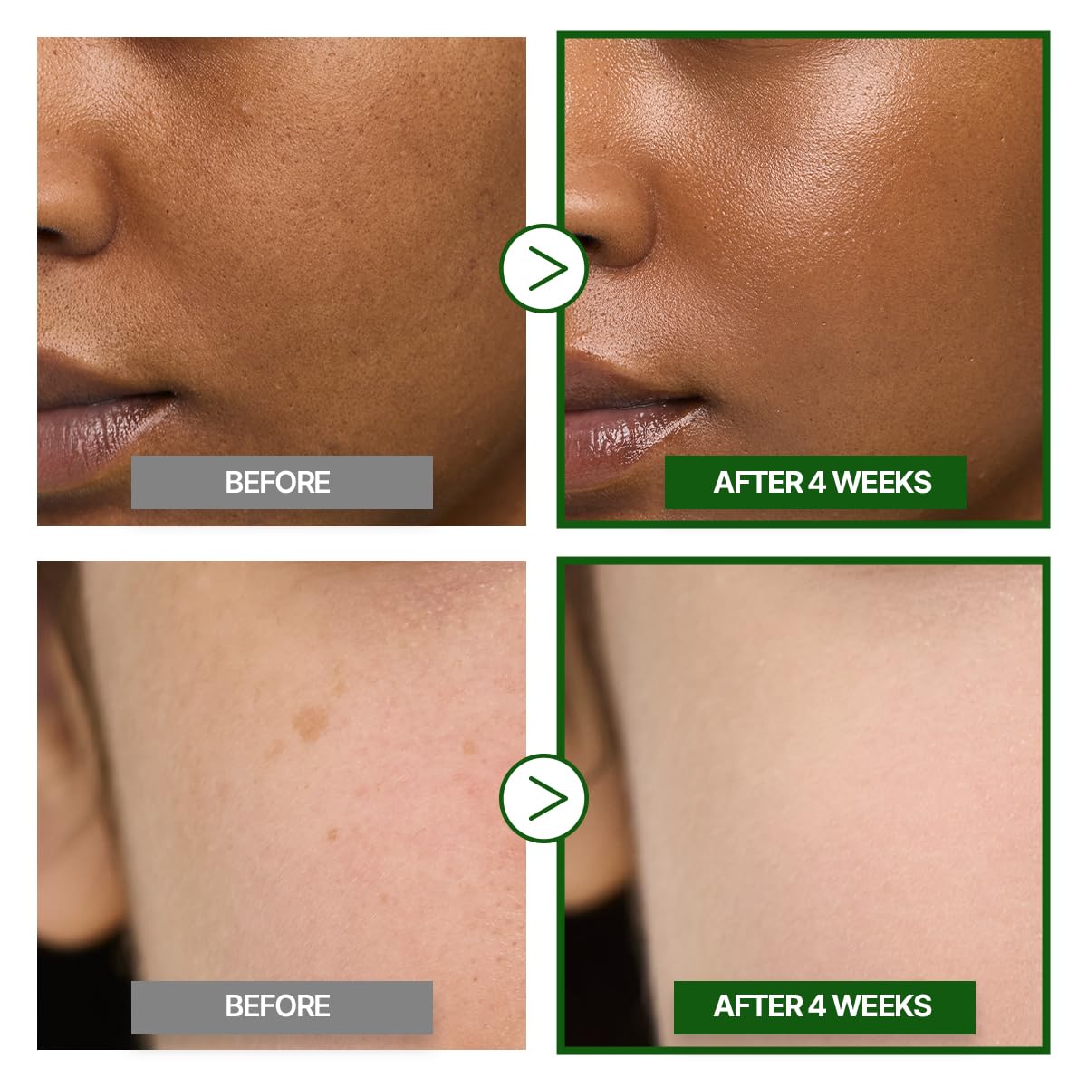 GOODAL Green Tangerine Vitamin C Cream [Advanced Ver.] – Vitamin C Cream with 5% Niacinamide |