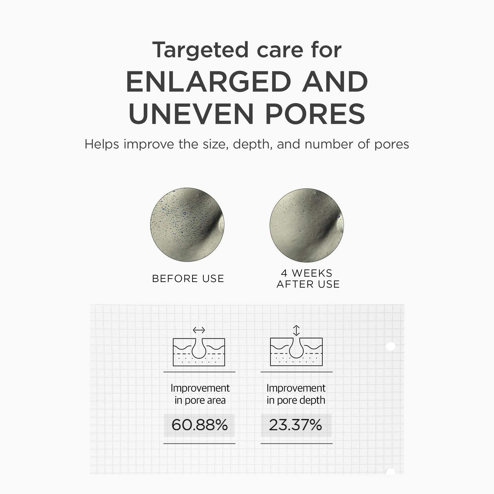 SKIN1004 Niacinamide 10% Boosting Shot Ampoule, Niacinamide Spicule Serum for Face, Facial Ampoule