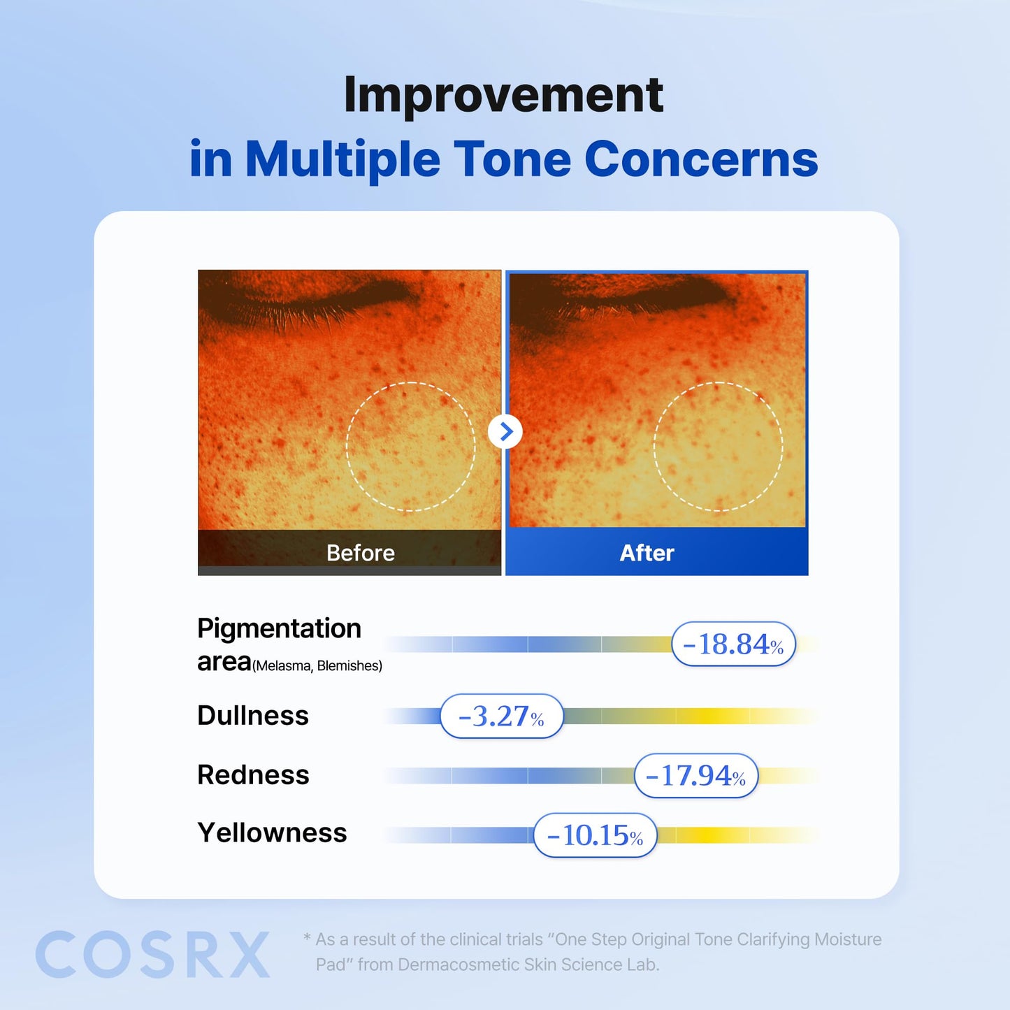 COSRX OneStep Tone Clarifying Toner Pads, Even Skin & Hydration (100 Pads)