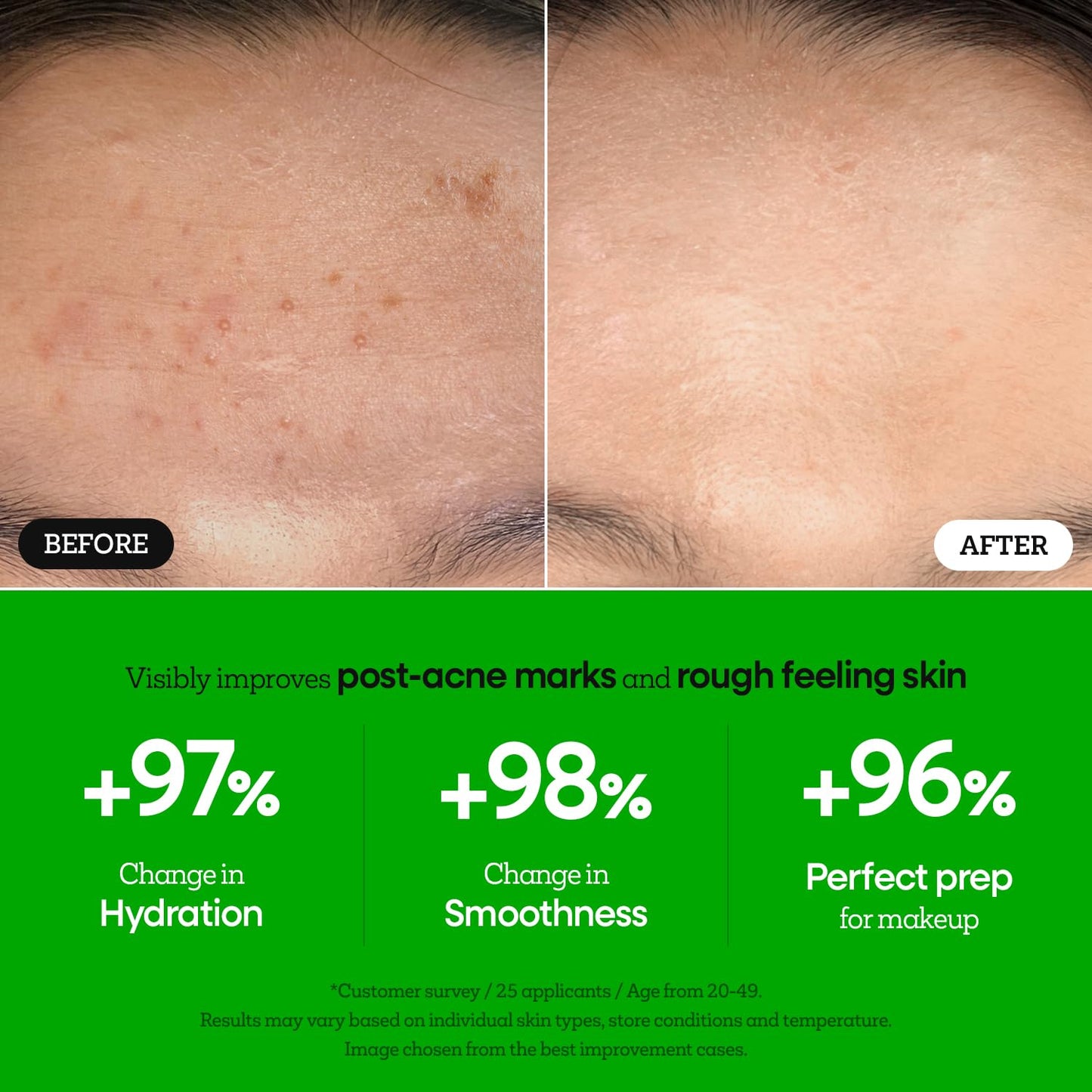 Nature Republic The First Peptide Boosting Serum | Niacinamide, Adenosine, Hydrating & Firming