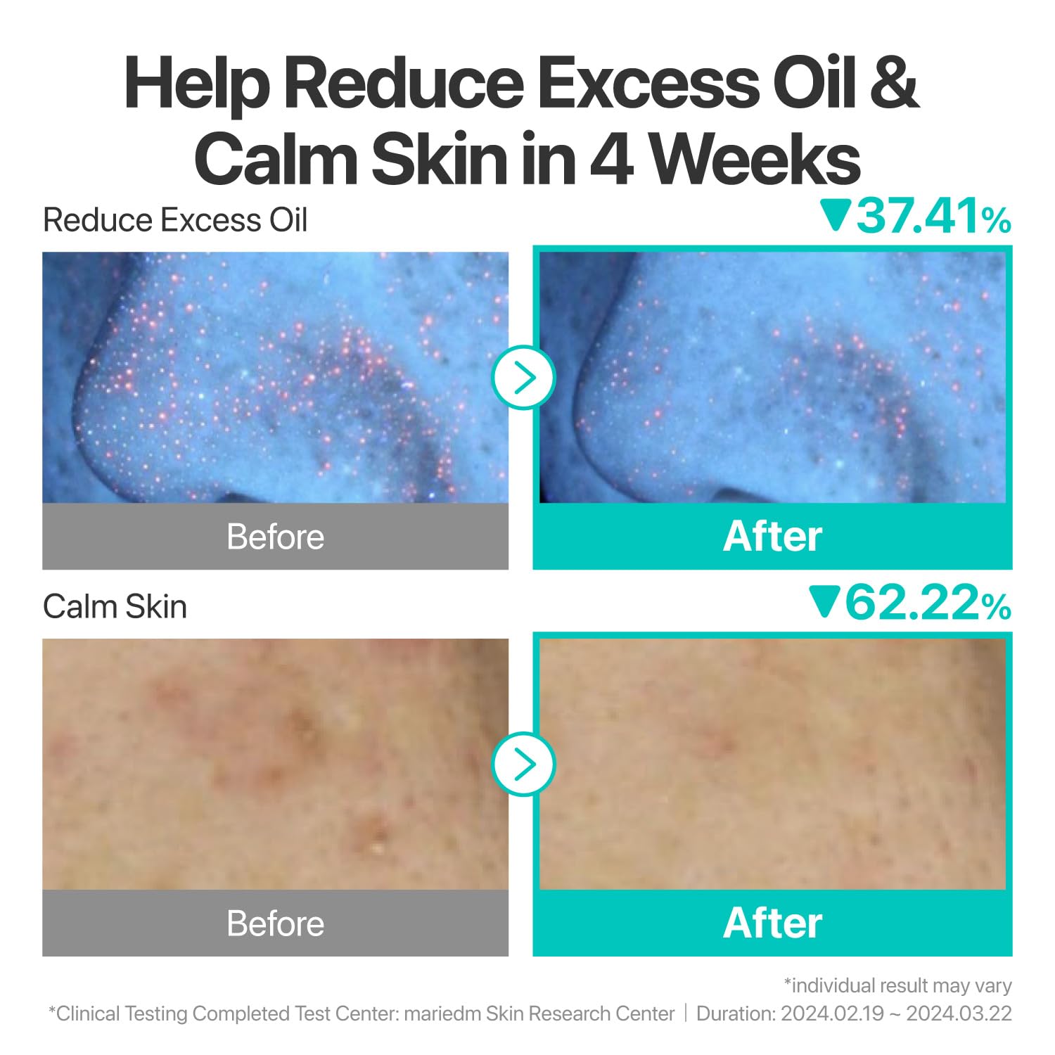 numbuzin No.1 Serum | Pantothenic B5 Active Soothing Serum | Soothing, Hydrating | Pantothenic