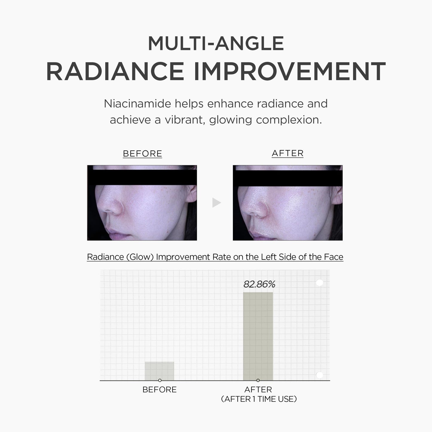 SKIN1004 Niacinamide 10% Boosting Shot Ampoule, Niacinamide Spicule Serum for Face, Facial Ampoule