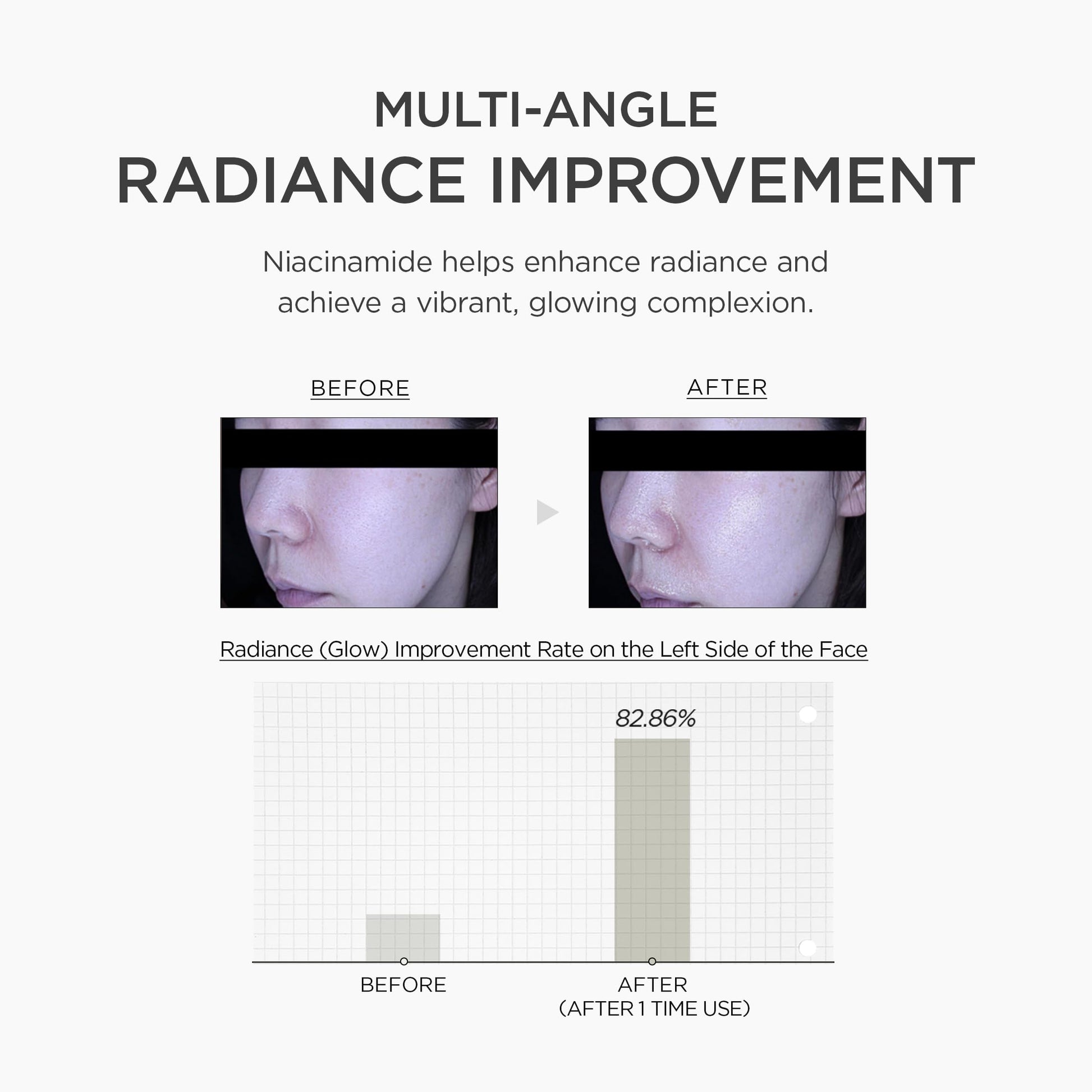 SKIN1004 Niacinamide 10% Boosting Shot Ampoule, Niacinamide Spicule Serum for Face, Facial Ampoule