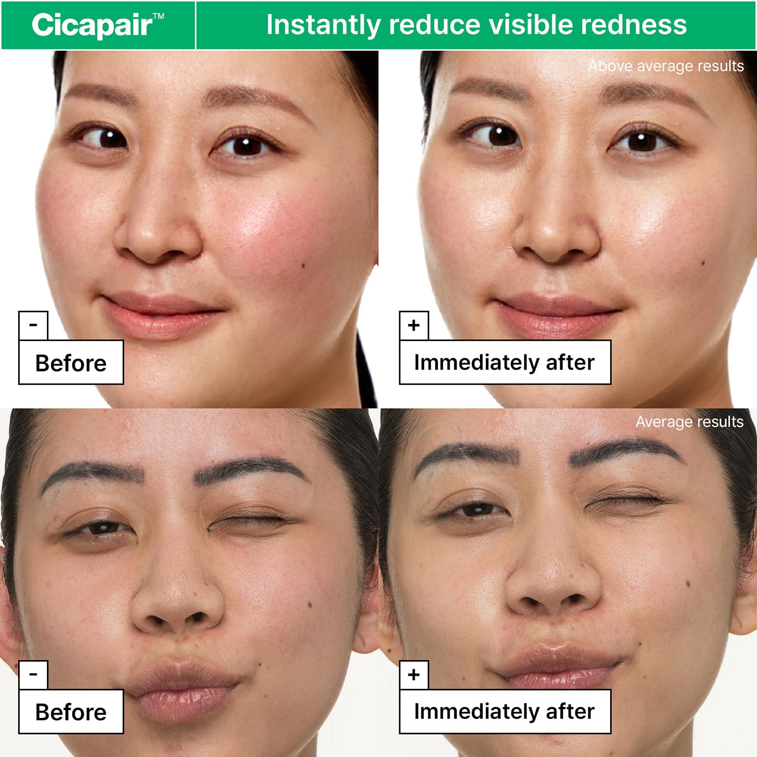 Dr.Jart+ Cicapair Sensitive Skin Korean Face Moisturizer for Redness and Barrier Repair with