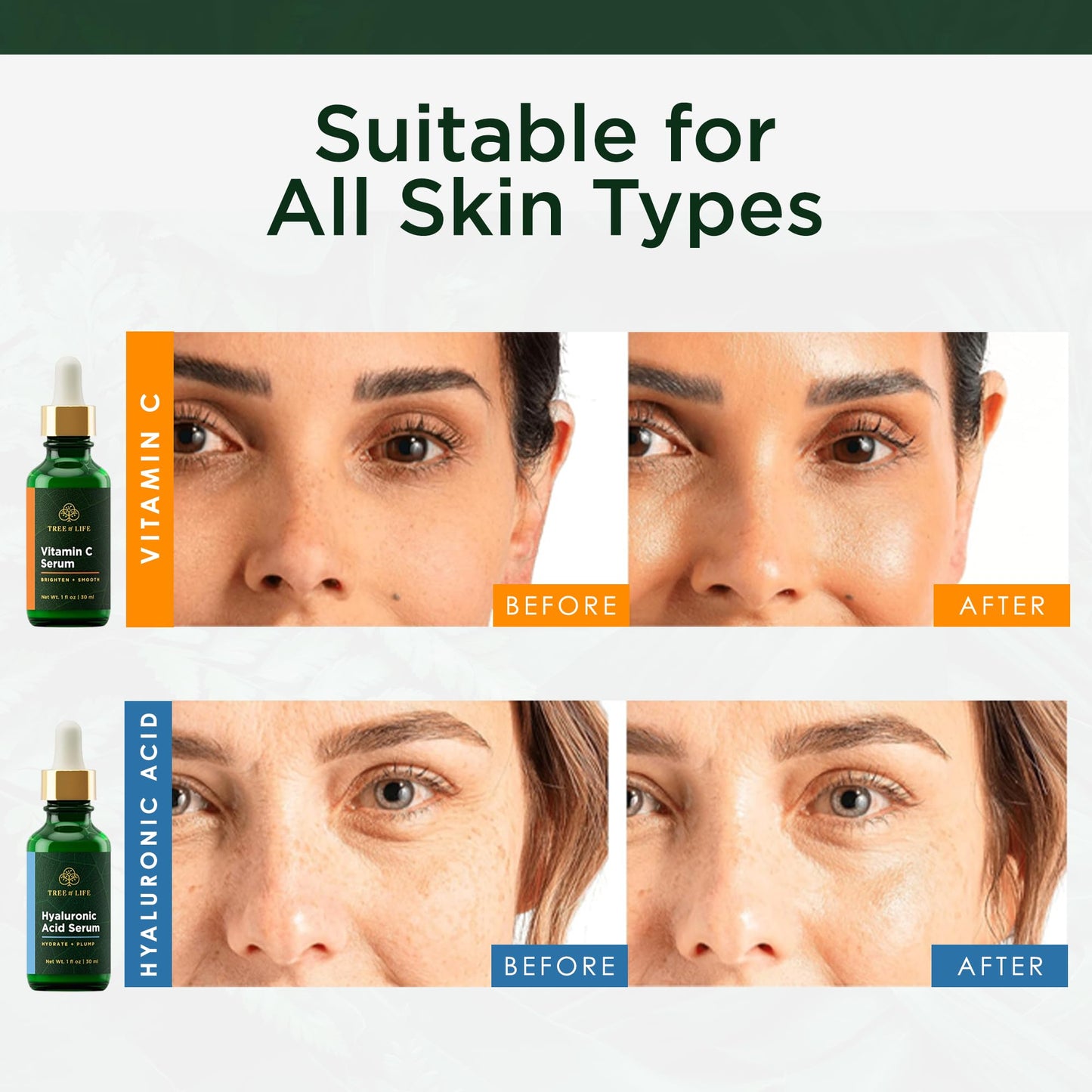 Tree of Life Face Serum Skin Care, Facial Serum for Women and Men, Set of 2