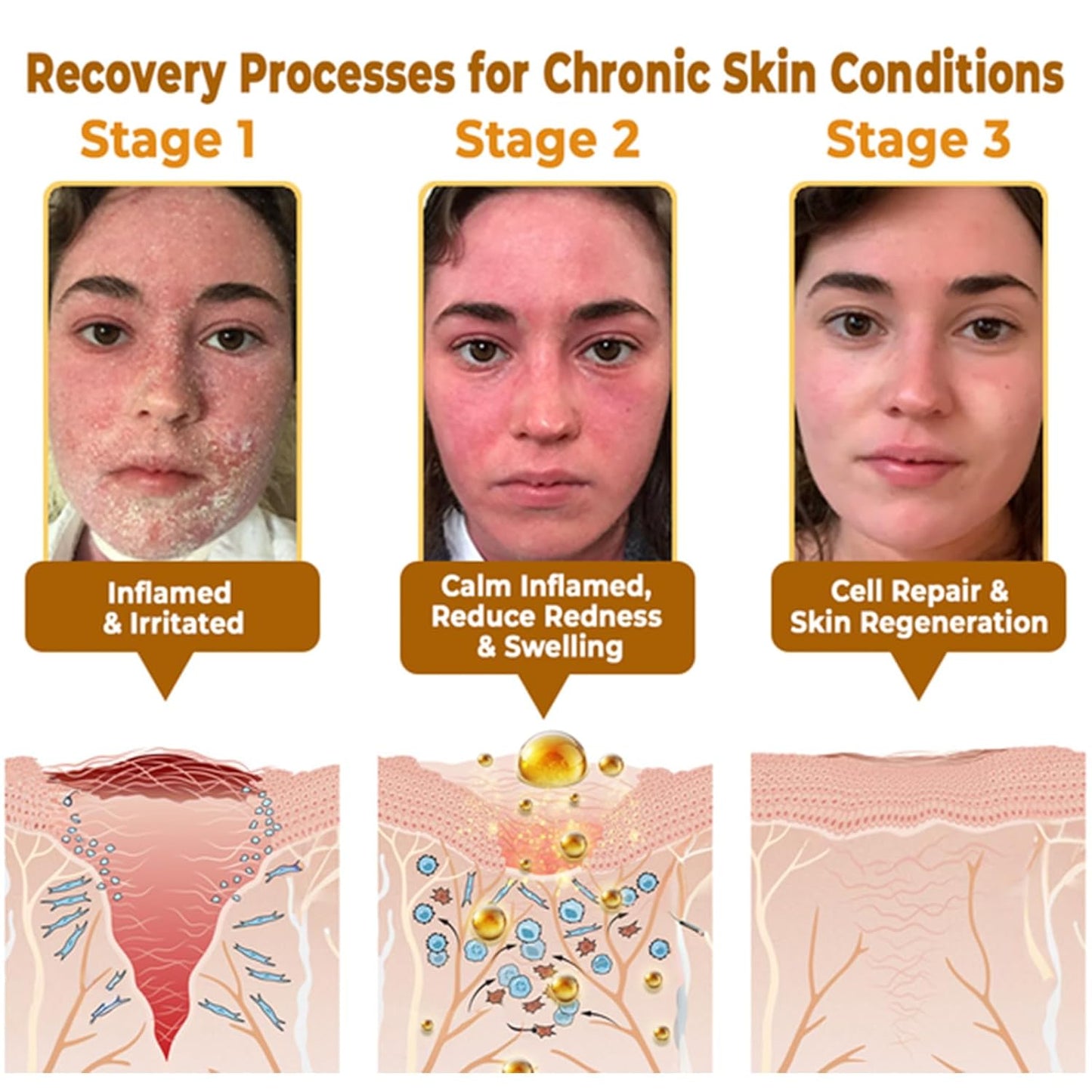 LipMaps Bee Venom Skin Restoration Cream, Bee Venom Skin Treatment Cream, Repair skin and Firming, Effective In Reducing Blemishes (2)