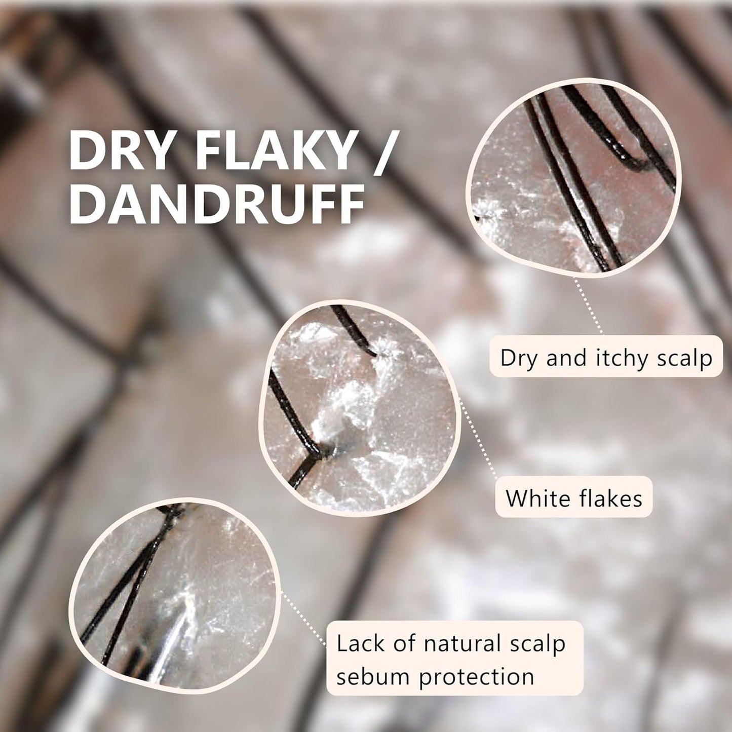 Aromase Dry Scalp Soothing Shampoo - Hydrates, Relieves Dryness and Itchiness - Amino Acid-Based Formula - No Parabens, SLS, or Silicone - 14 oz