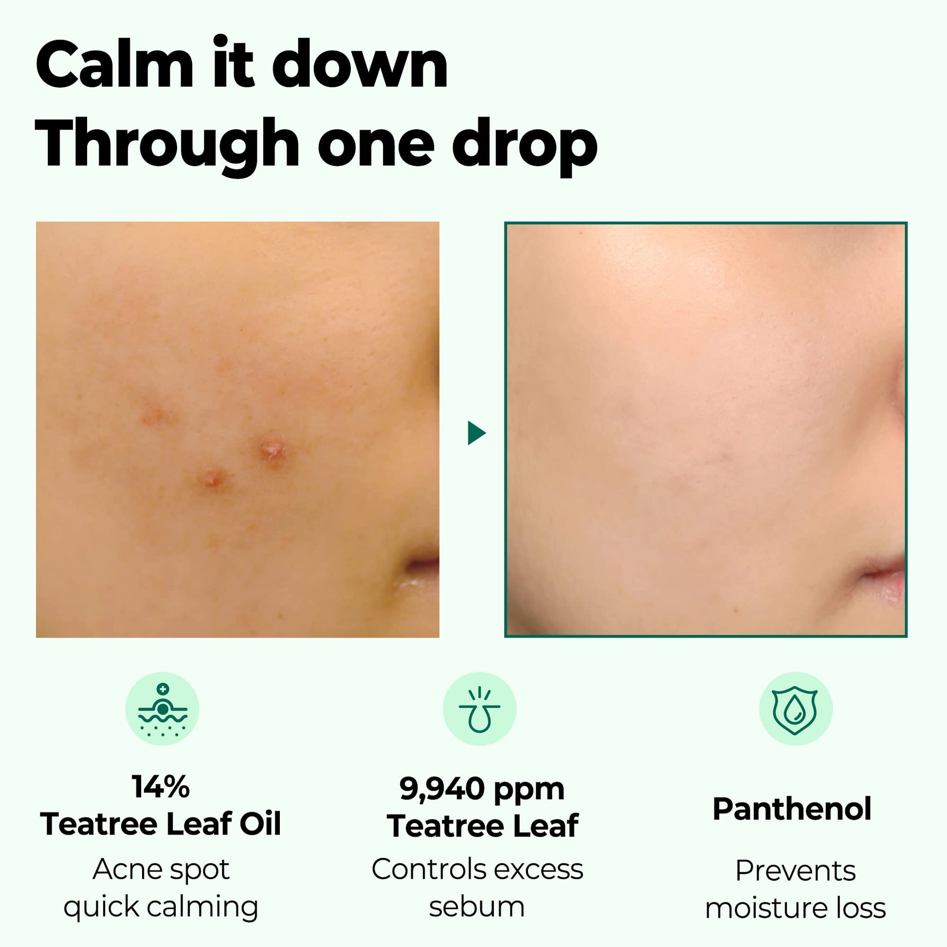 SOME BY MI 30 Days Miracle Tea Tree Clear Spot Oil / 0.33Oz, 10ml / Made from Tea tree Leaf Water