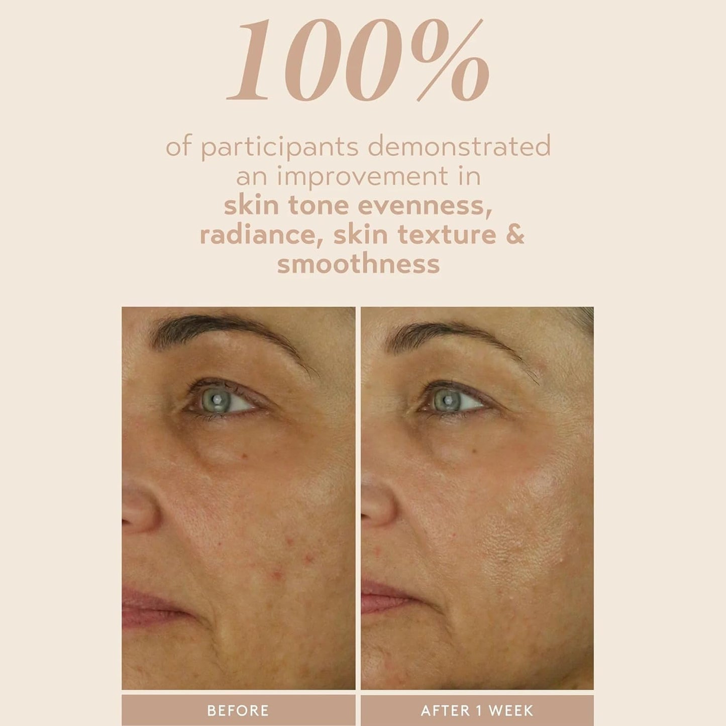 SHANI DARDEN SKIN CARE Retinol Reform with 1% Encapsulated Retinol Serum for Face & Neck, Gentle Slow-Release Face Serum with Tripeptide for Wrinkles, Fine Lines & Uneven Tone, 1 fl oz