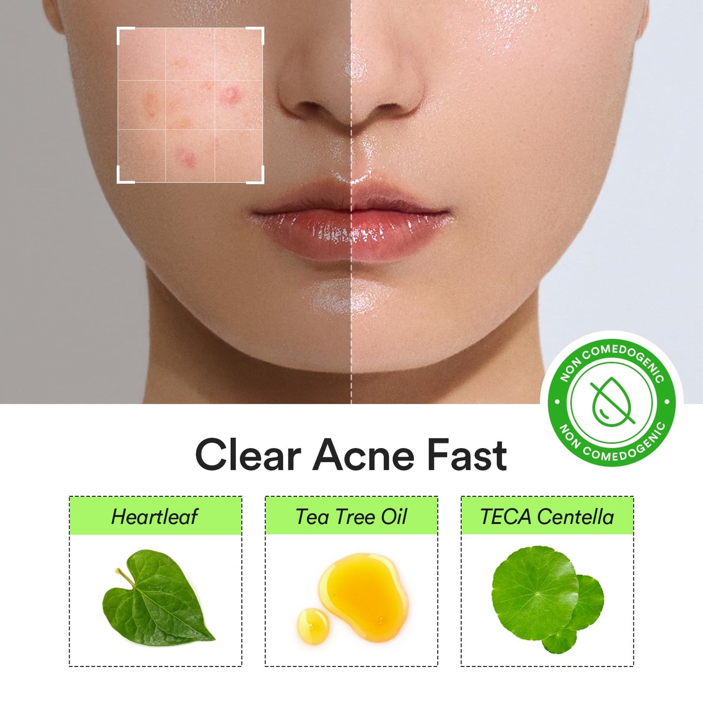 Abib Heartleaf Calming Spot Patch 2 Sizes 78 Patches, Waterproof Pimple Patches for Face