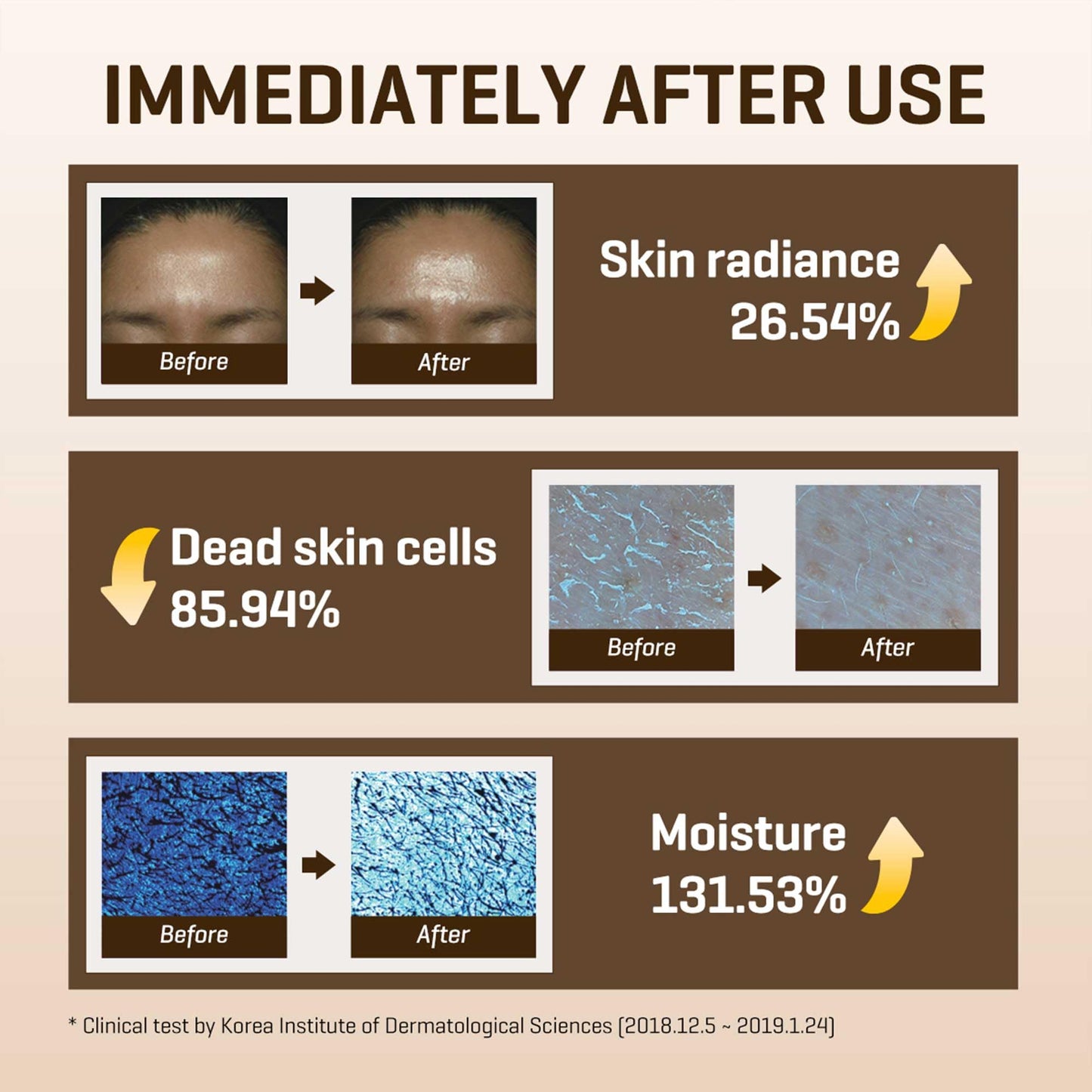 SOME BY MI Galactomyces Pure Vitamin C Glow Toner - 6.76Oz, 200ml - Korean Daily Vitamin C Face