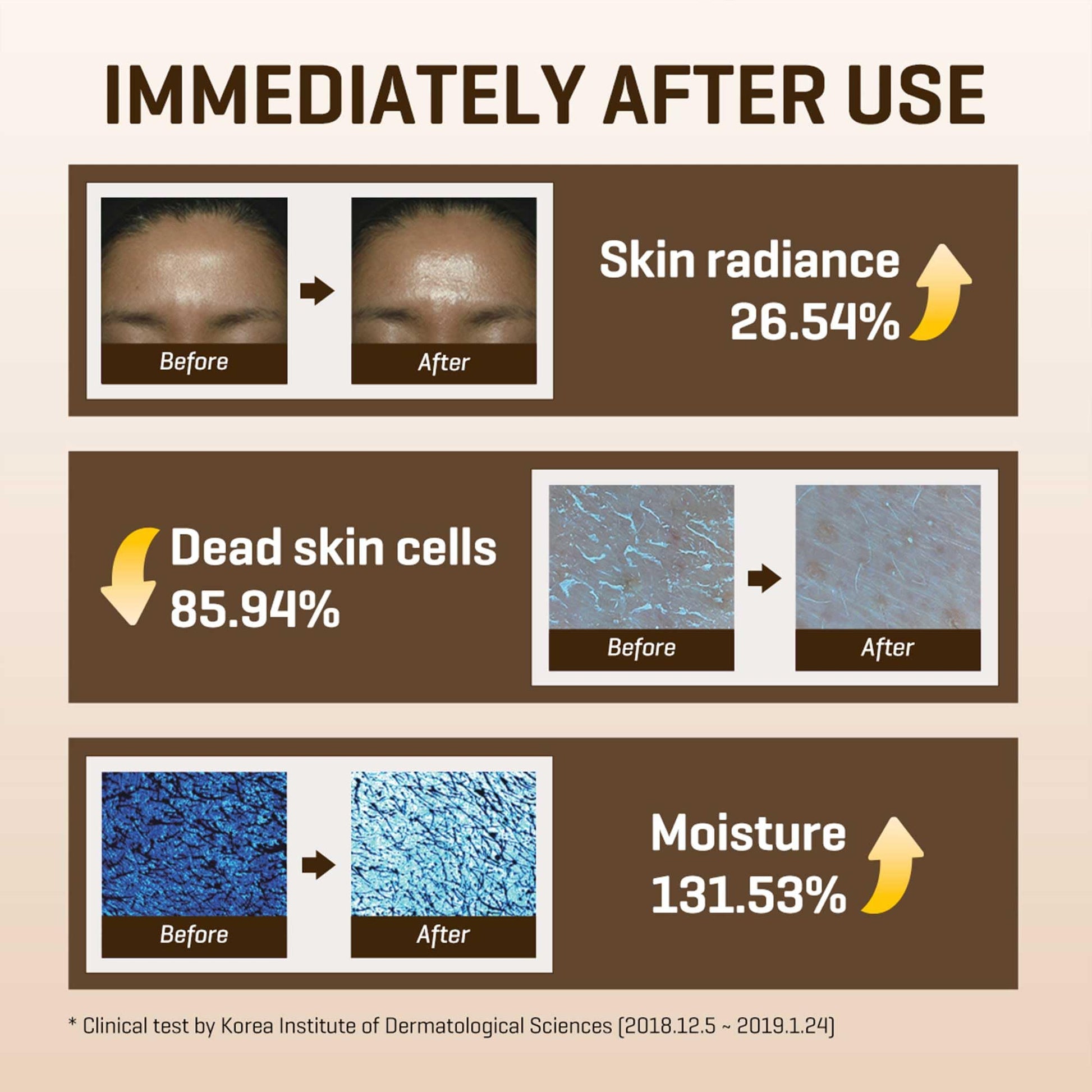 SOME BY MI Galactomyces Pure Vitamin C Glow Toner - 6.76Oz, 200ml - Korean Daily Vitamin C Face
