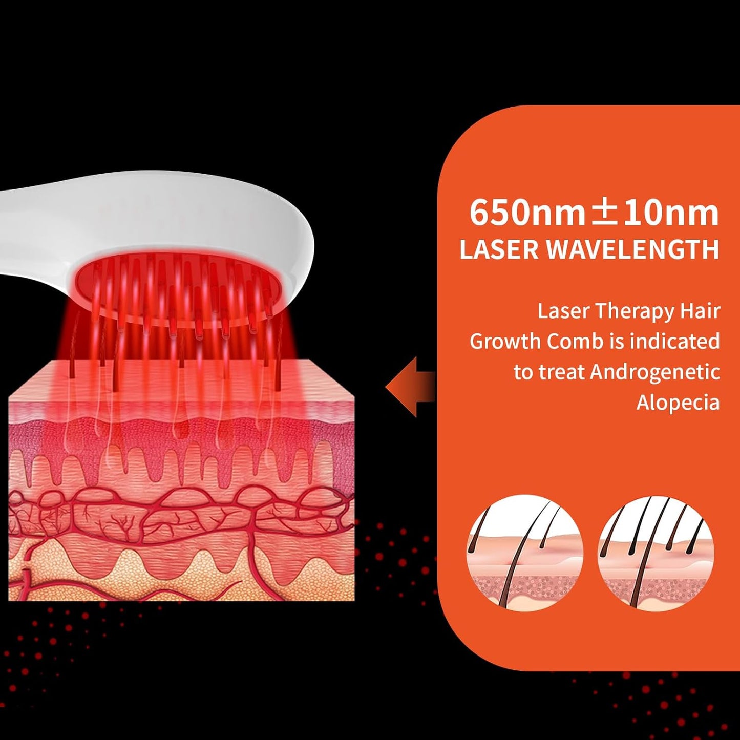 Laser Therapy Hair Growth Comb, Hand-Held Comb-Shaped Low Level Laser Therapy To Promote Hair Growth in Women and Men