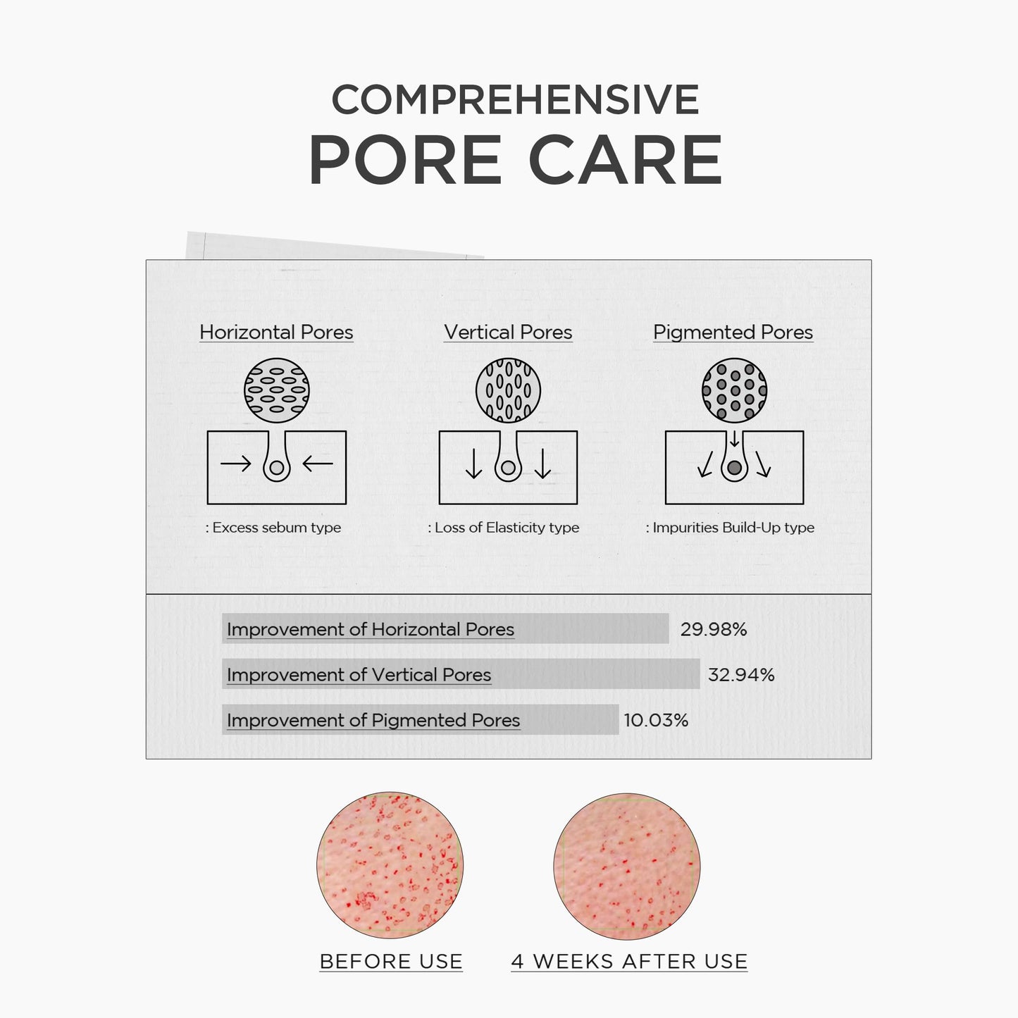 SKIN1004 Niacinamide 10% Boosting Shot Ampoule, Niacinamide Spicule Serum for Face, Facial Ampoule