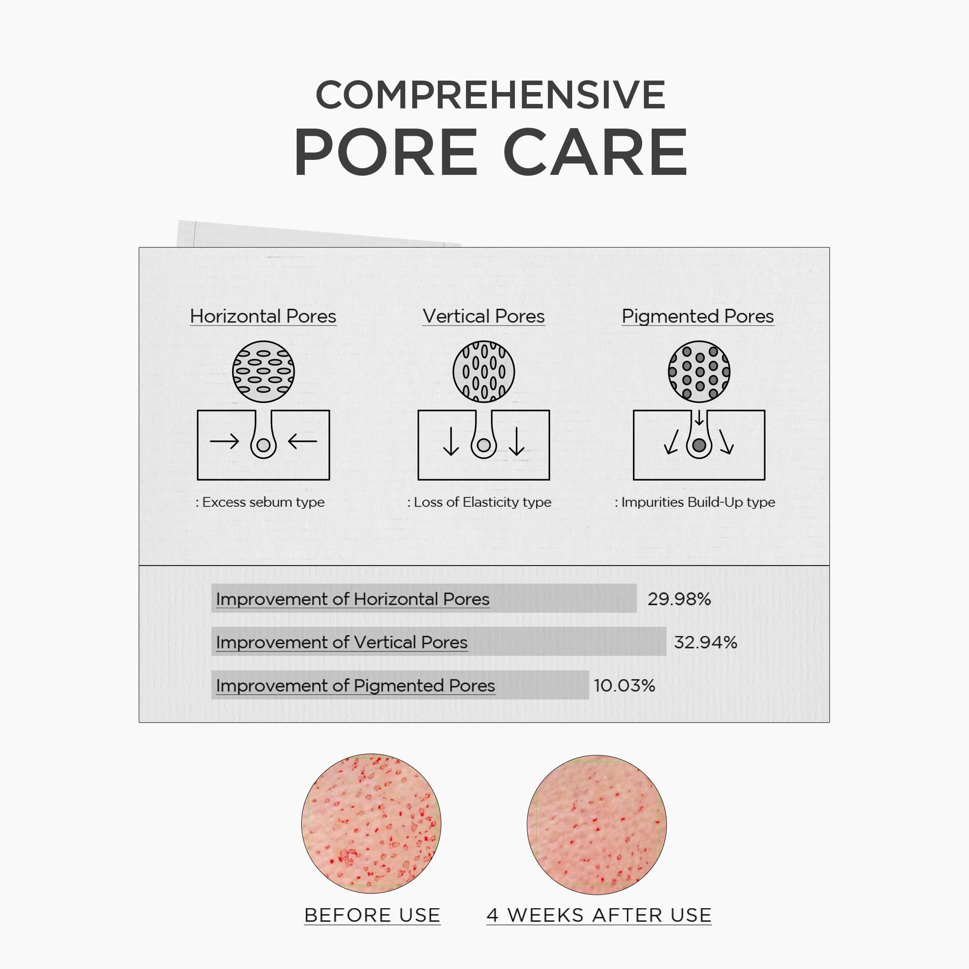 SKIN1004 Niacinamide 10% Boosting Shot Ampoule, Niacinamide Spicule Serum for Face, Facial Ampoule