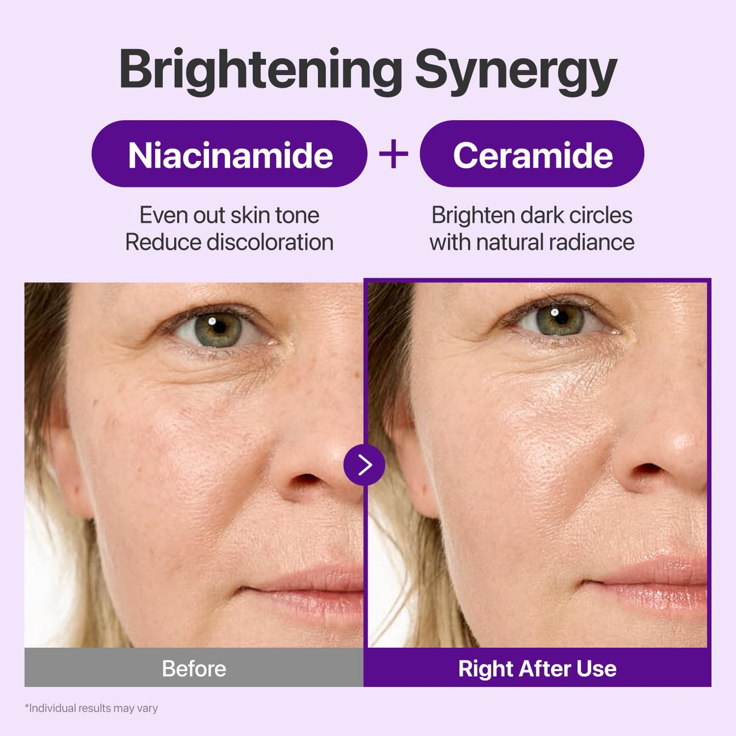 numbuzin No.9 NAD+ Retinal Eye Cream for Anti-Aging, Keratosis Pilaris, Strawberry Skin, Firmer