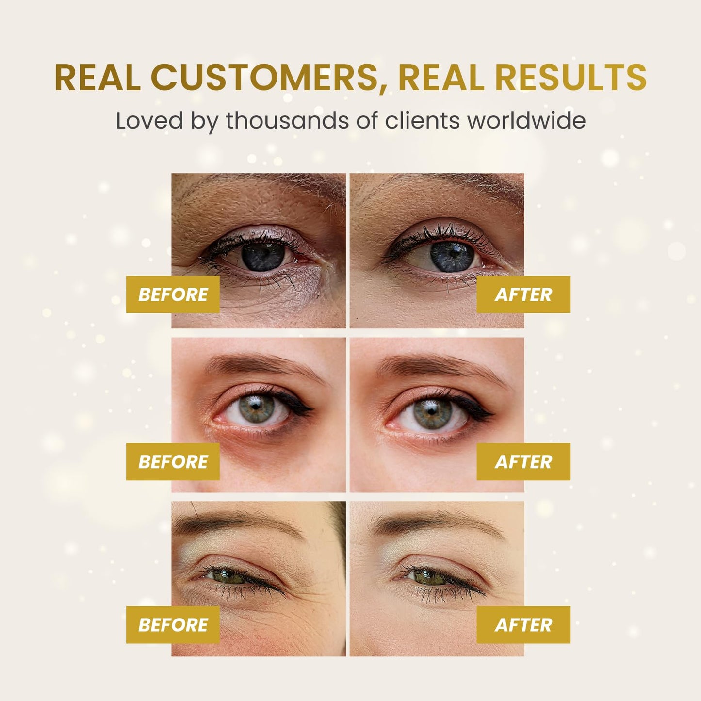 PLANTIFIQUE Gold Under Eye Patches for Puffy Eyes 40 Pairs | Under Eye Masks for Dark Circles | Puffiness Eye Gels with Collagen & Caffeine | Anti Aging Gold Eye Mask Skincare