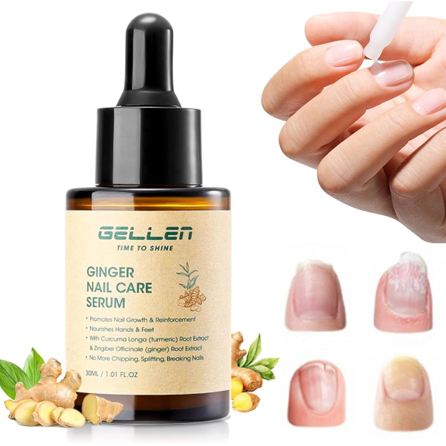 Gellen 30ml Ginger Nail Growth Serum for Nail Strengthener and Growth, Nail Repair Treatment for Weak Brittle Splitting Damaged Nails, Hydrated & Nourished Nail Care Solution for Hands & Feet