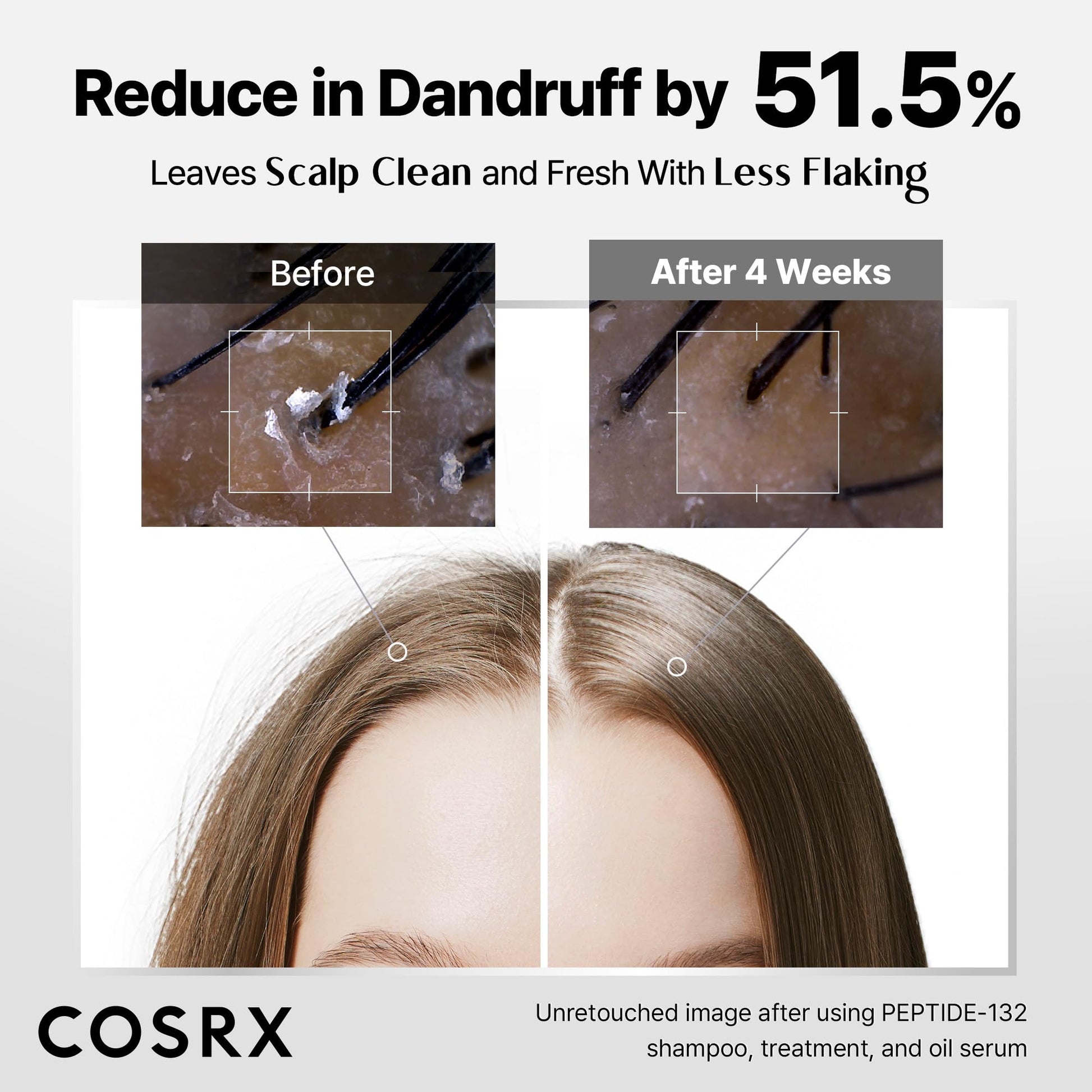 COSRX PEPTIDE 132 Hair Care Kit, Scalp Care Shampoo, Treatment & Serum