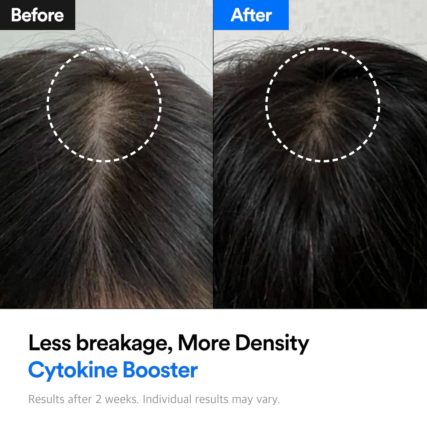 Hair-Recovery Cytokine Booster, 3.38 Fl.Oz.– Hair Regrowth Tonic for Thinning Hair, Hair Loss Treatment, Stimulates Follicles, Thicker, Stronger Hair (Moisture)