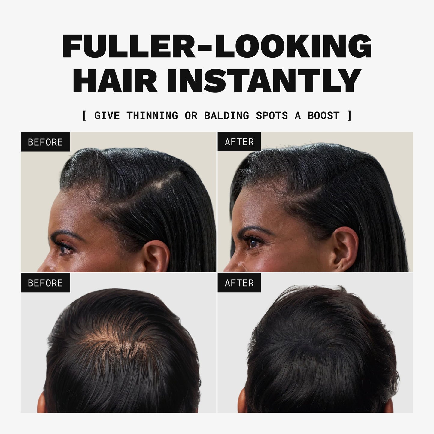 Toppik Hair Building Fibers, Light Brown, 27.5g Fill In Fine or Thinning Hair, Instantly Thicker