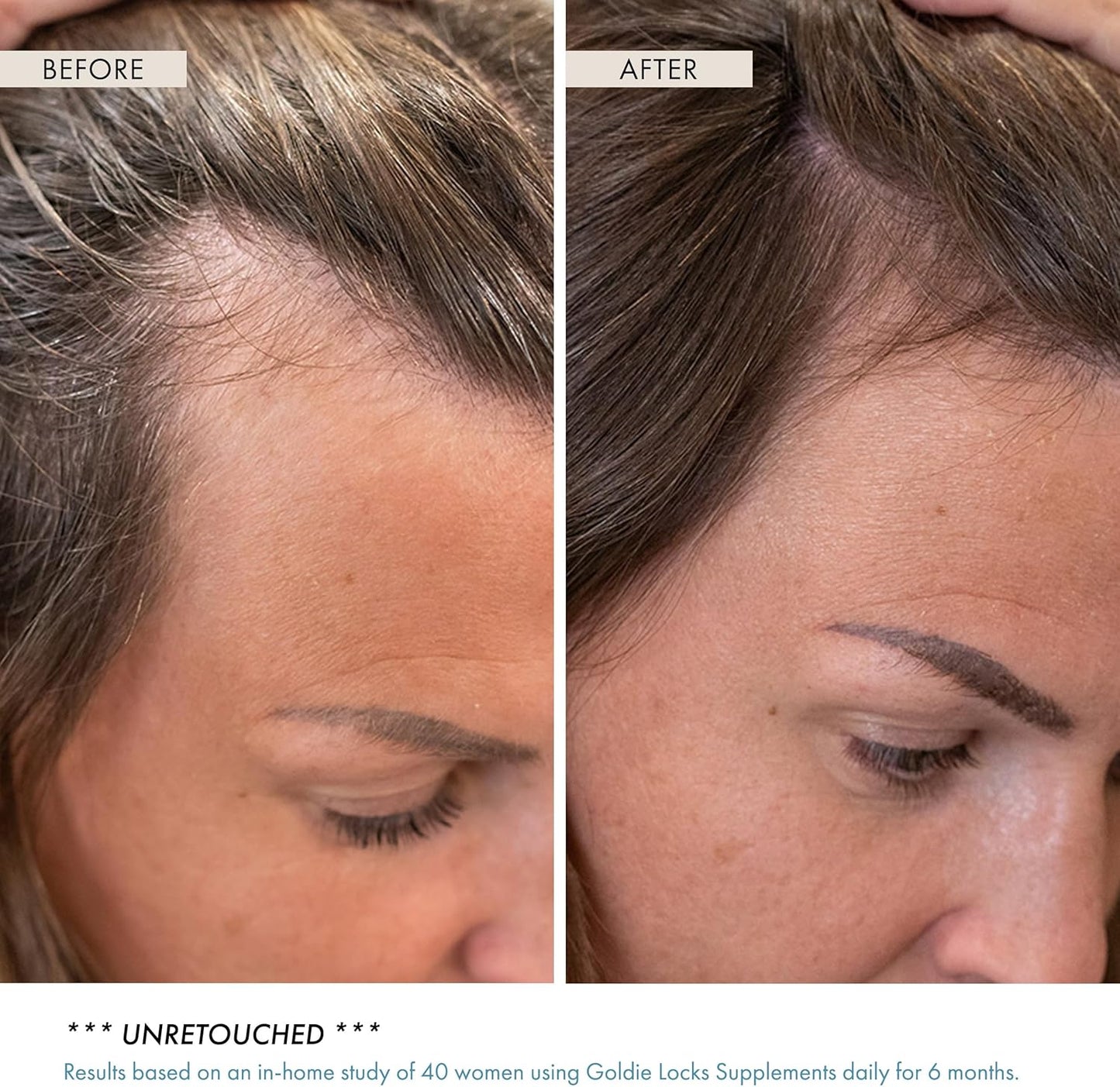 Goldie Locks Hair Growth Supplements Original Formula Refill, Hair Supplements for Stronger & Healthier Locks, Vitamins That Enhance Hair, Skin, and Nails, 120 Count