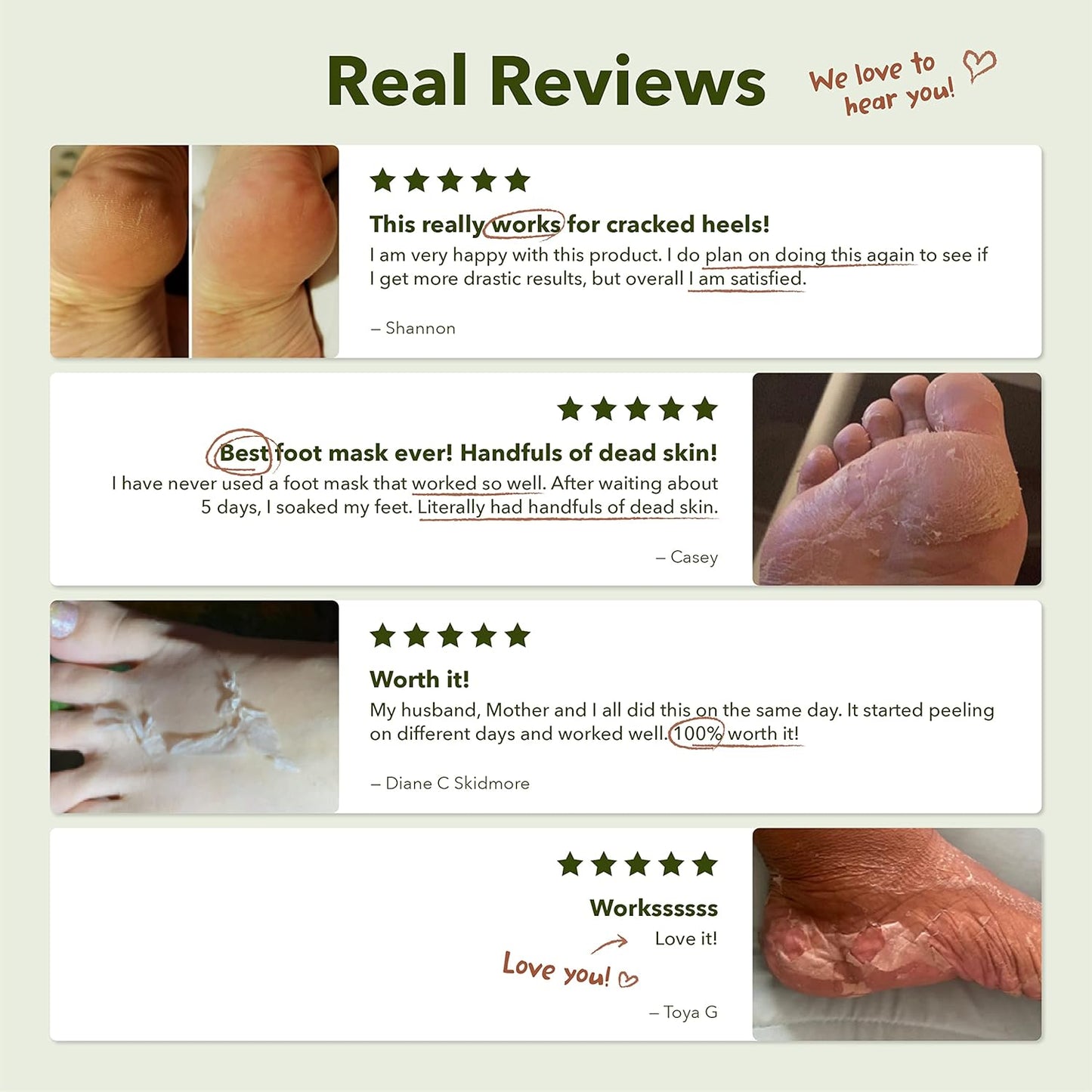 Purederm Shiny & Soft Foot Peeling Mask (6 pack) - For smooth and moist baby skin with Exfoliating peel off Calluses, Dry Skin, Cracked Heels - Men and Women